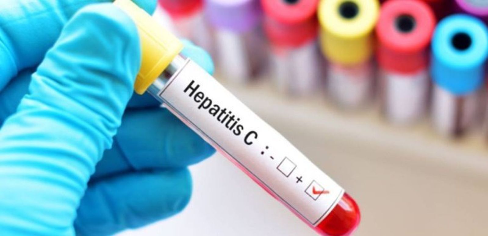 Test rápidos hepatitis C