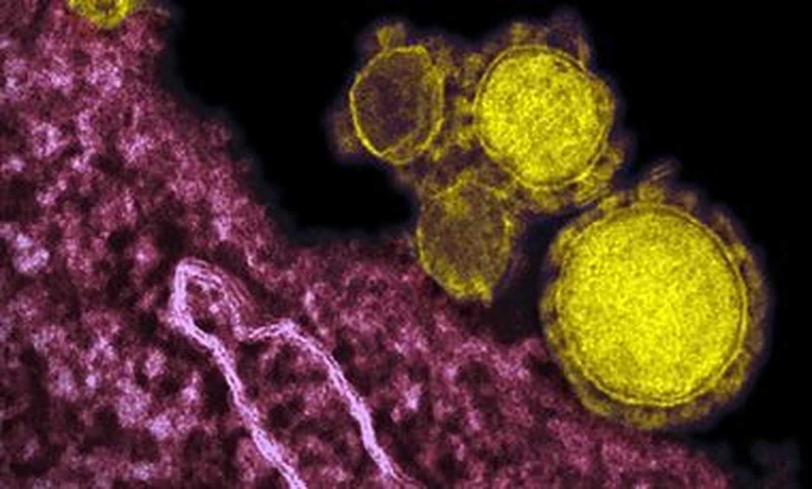 coronavirus4