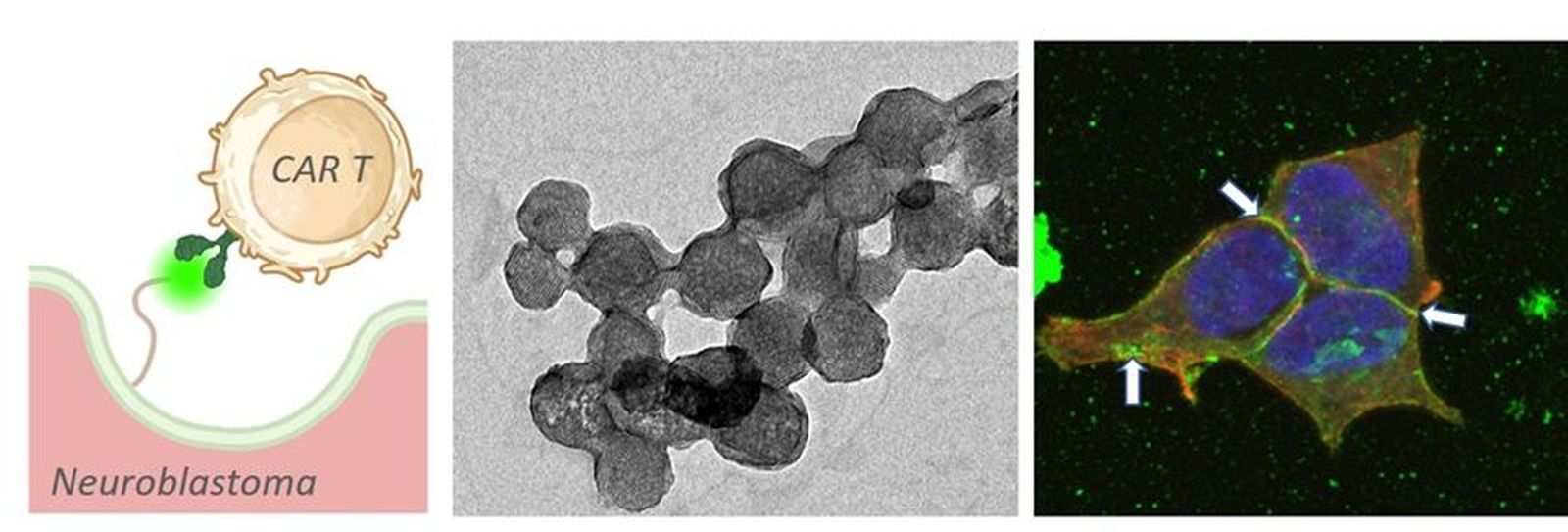 Imágenes microscópicas de las protocélulas y  de las células de neuroblastoma marcadas con fluoresceína (flechas blancas)