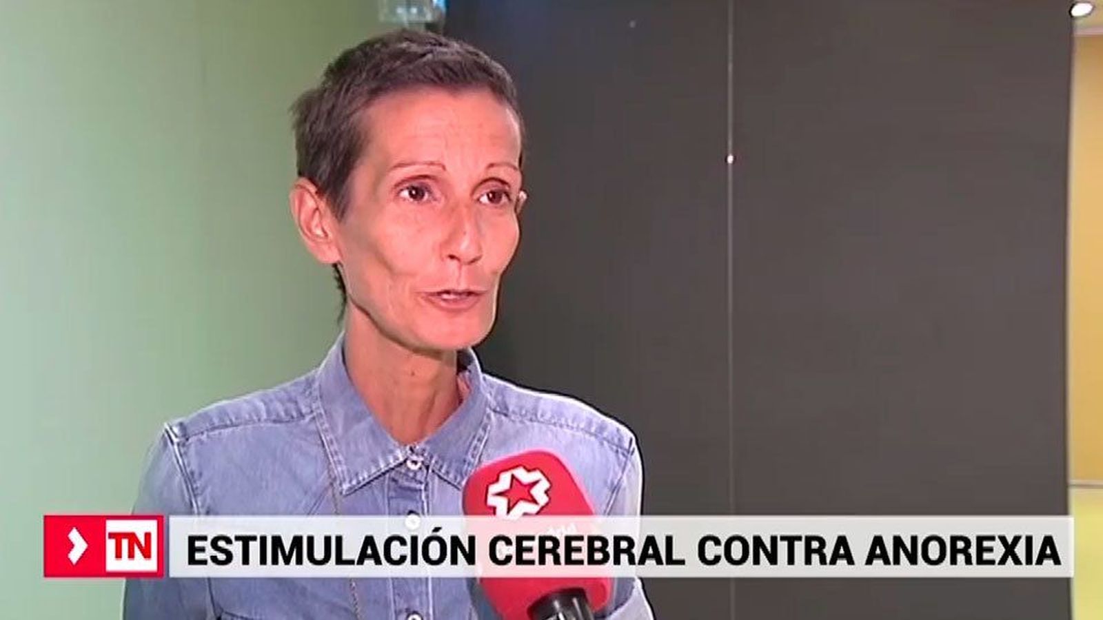 La estimulación cerebral podría ser la solución para tratar la anorexia severa y crónica