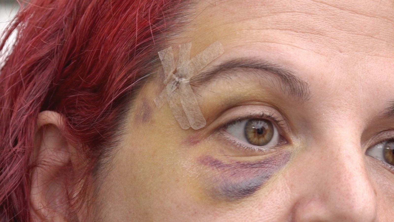 Se destroza el rostro por el mal estado de las aceras en Entrevías