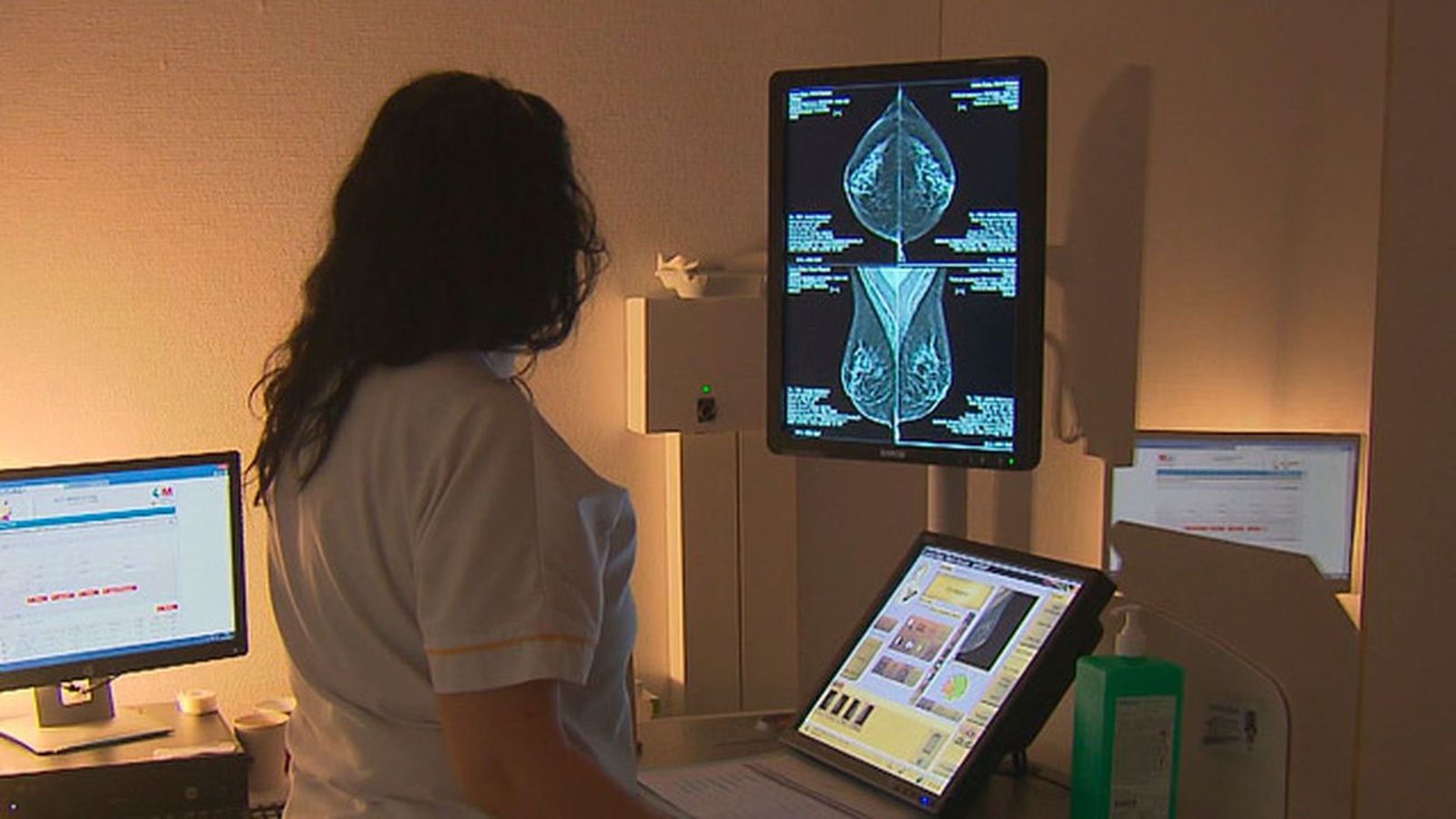 Se reanudan las mamografías en Madrid tras 9 meses de parón