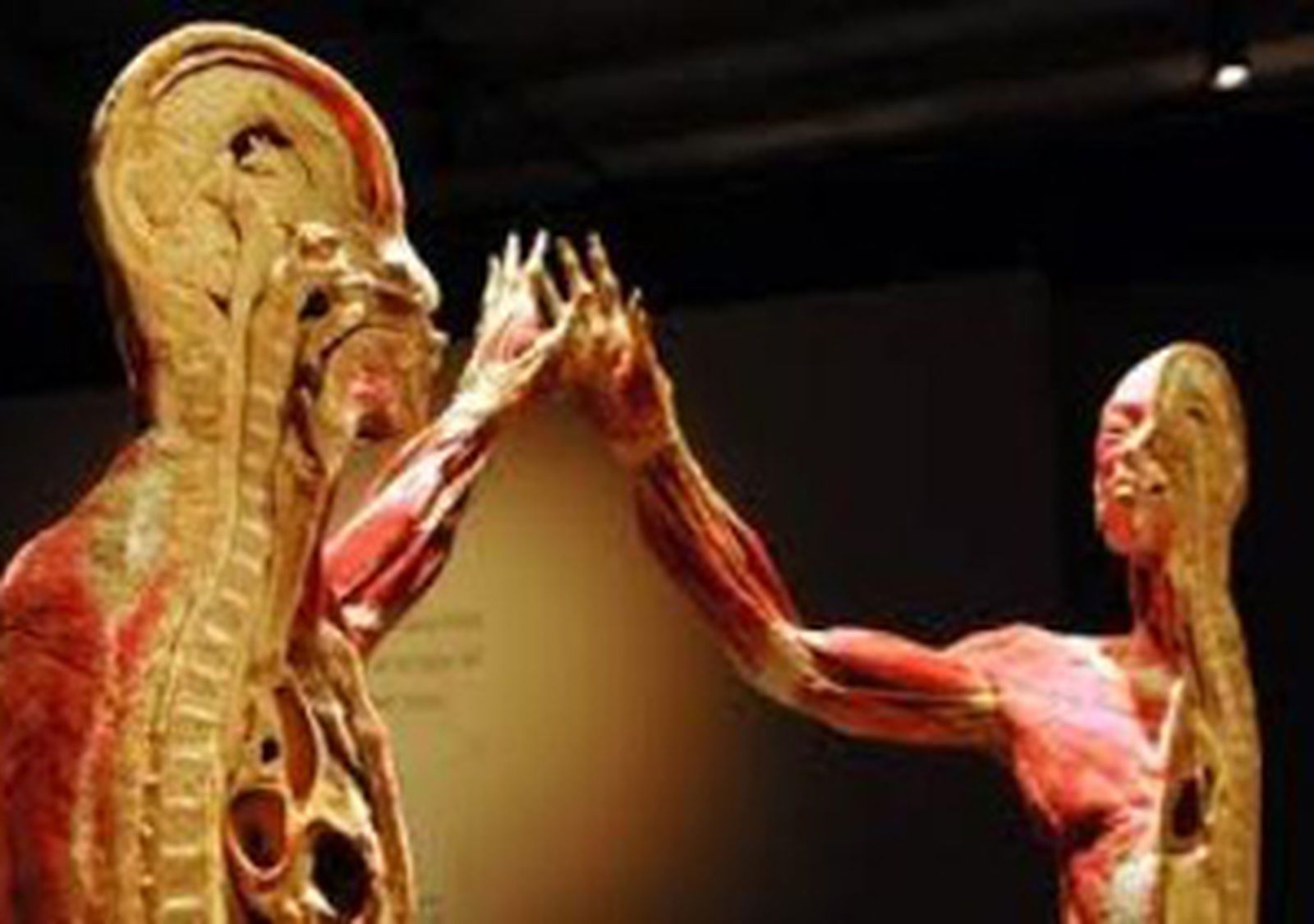 human _470