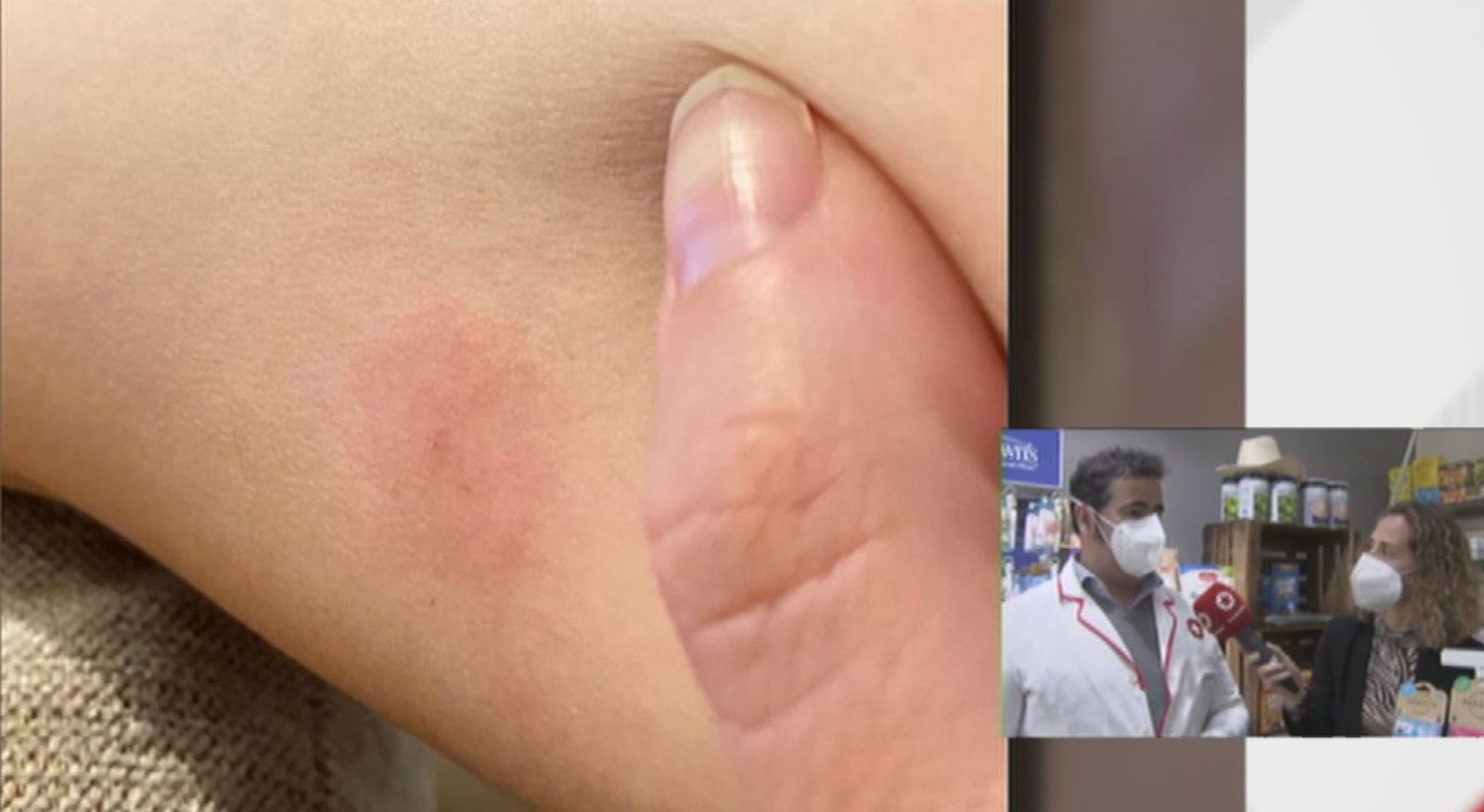 Los mosquitos atacan en Villaverde