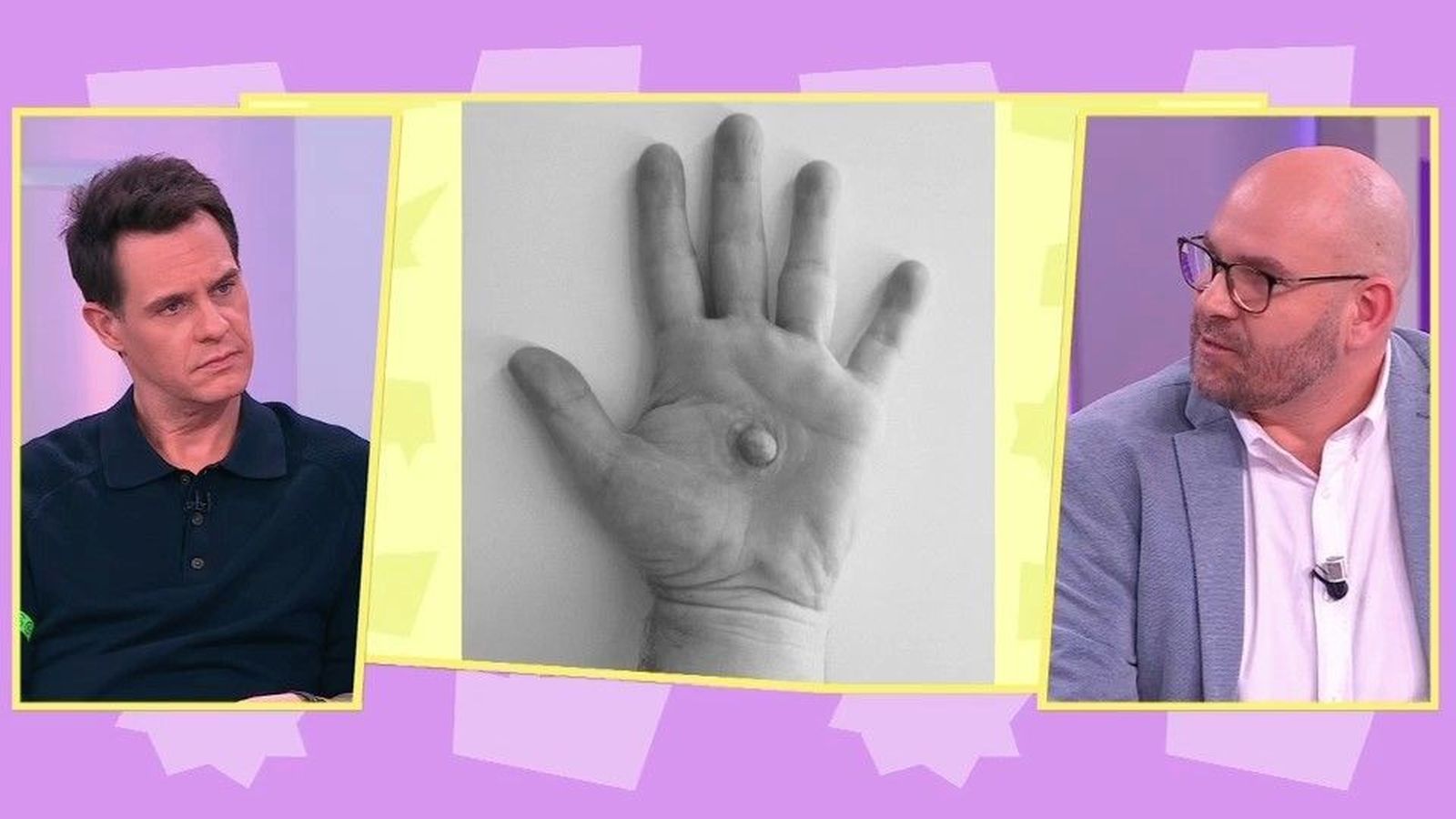 Alejandro Bralo impulsa prótesis que devuelven identidad tras el cáncer de mama