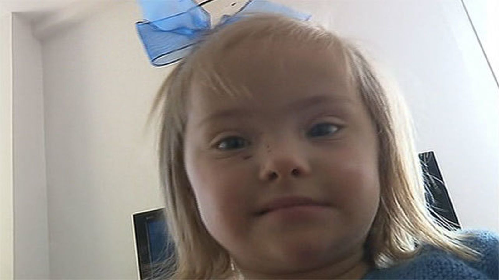 Una pequeña con síndrome de Down