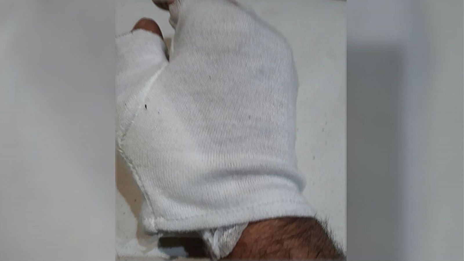 Atacado por un perro peligroso mientras miraba un escaparate