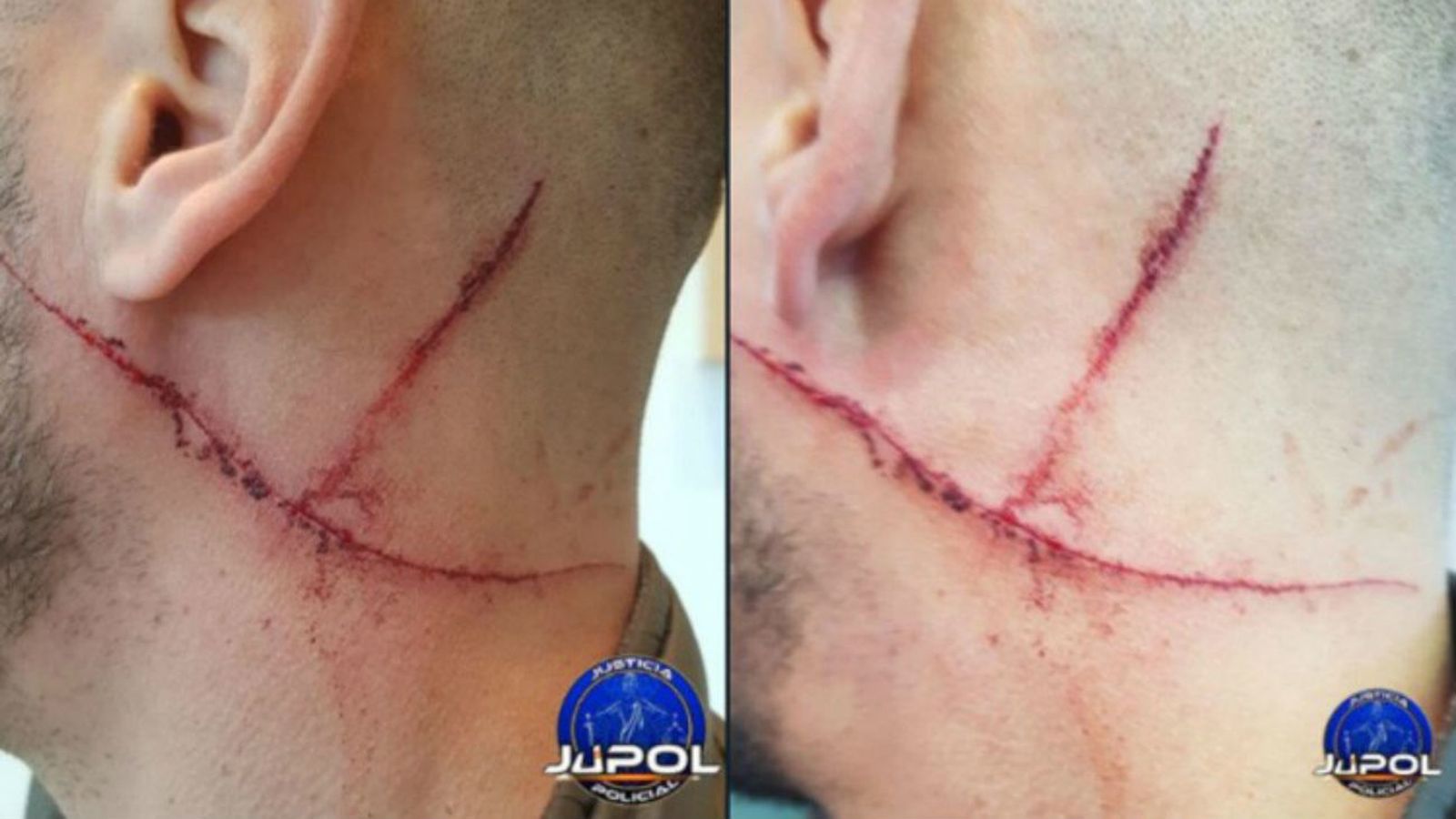 Heridas en el cuello del GEO