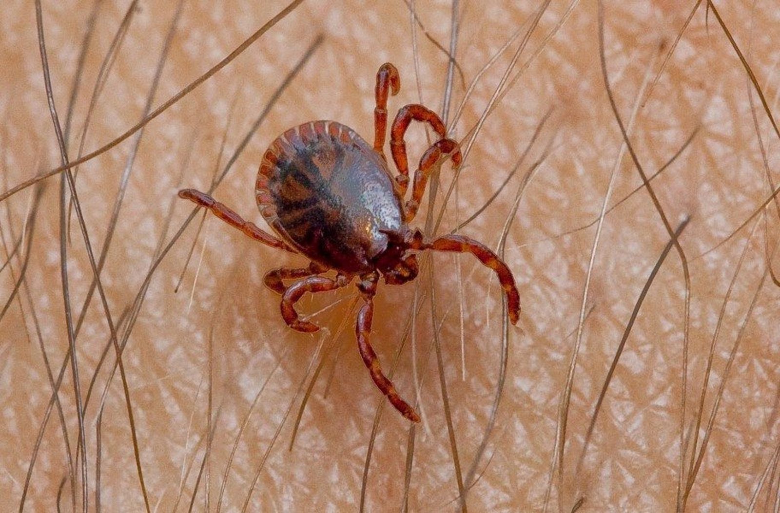 Imagen de una garrapata