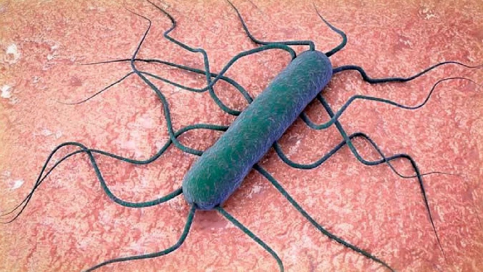 Cómo podemos evitar la listeriosis durante el embarazo