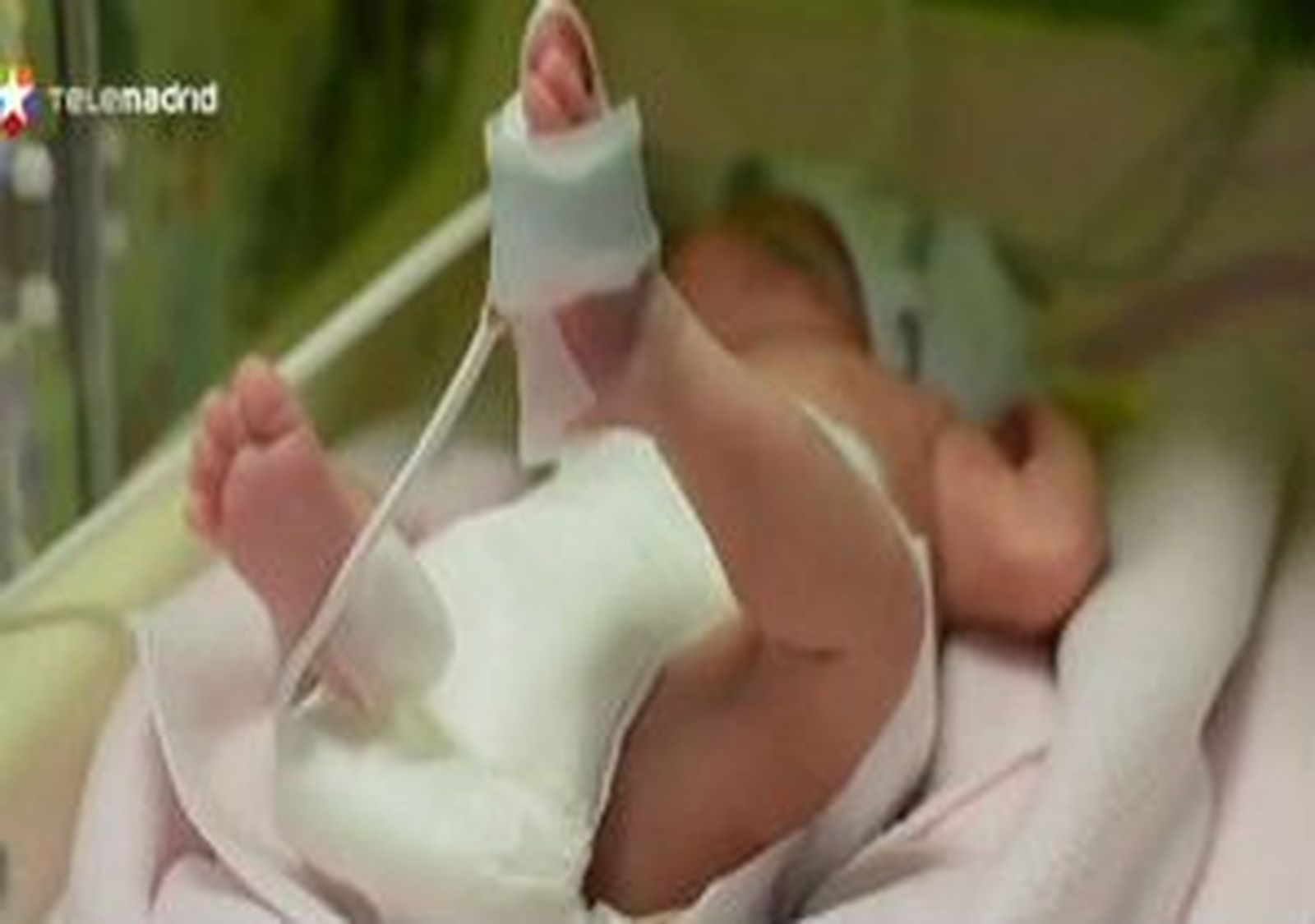 Nace un bebé que pasó tres meses en el útero de su madre en estado de muerte cerebral