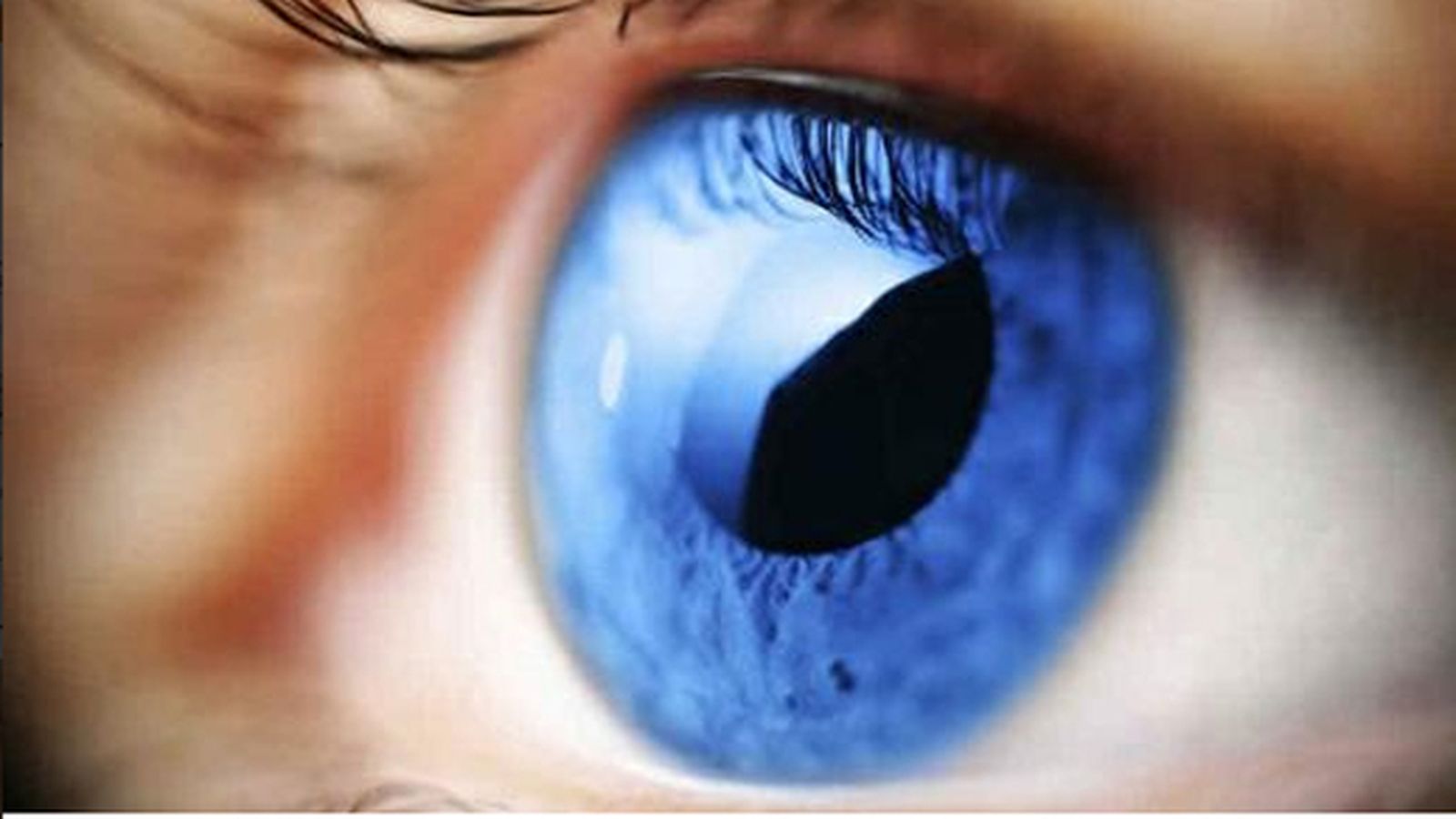 once_ojo_glaucoma