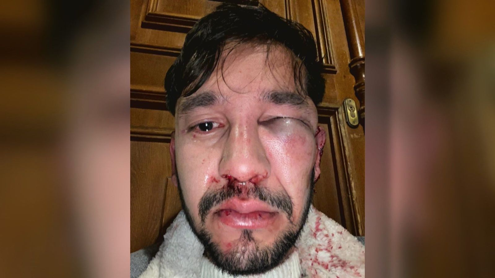 Agresión homófoba en Ópera a un joven: “Maricón de mierda, te voy a matar”