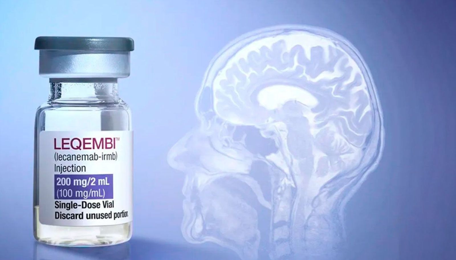 La Comisión Europea autoriza 'Leqembi', el primer tratamiento que ralentiza el deterioro cognitivo en alzhéimer