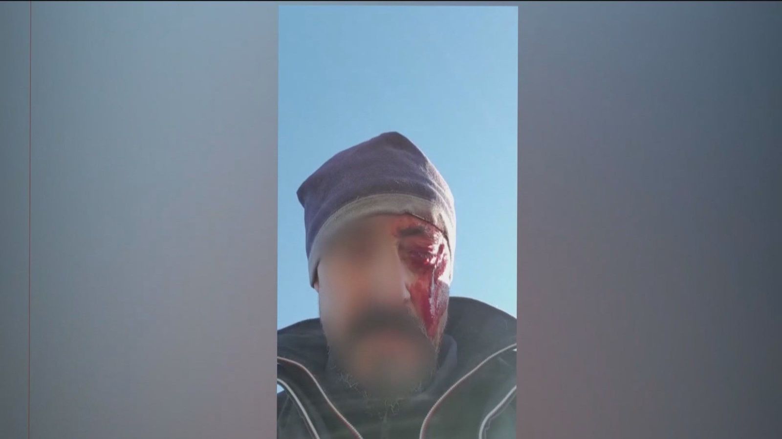 Dos cazadores detenidos tras una pelea con dos vecinos de Casarrubios del Monte