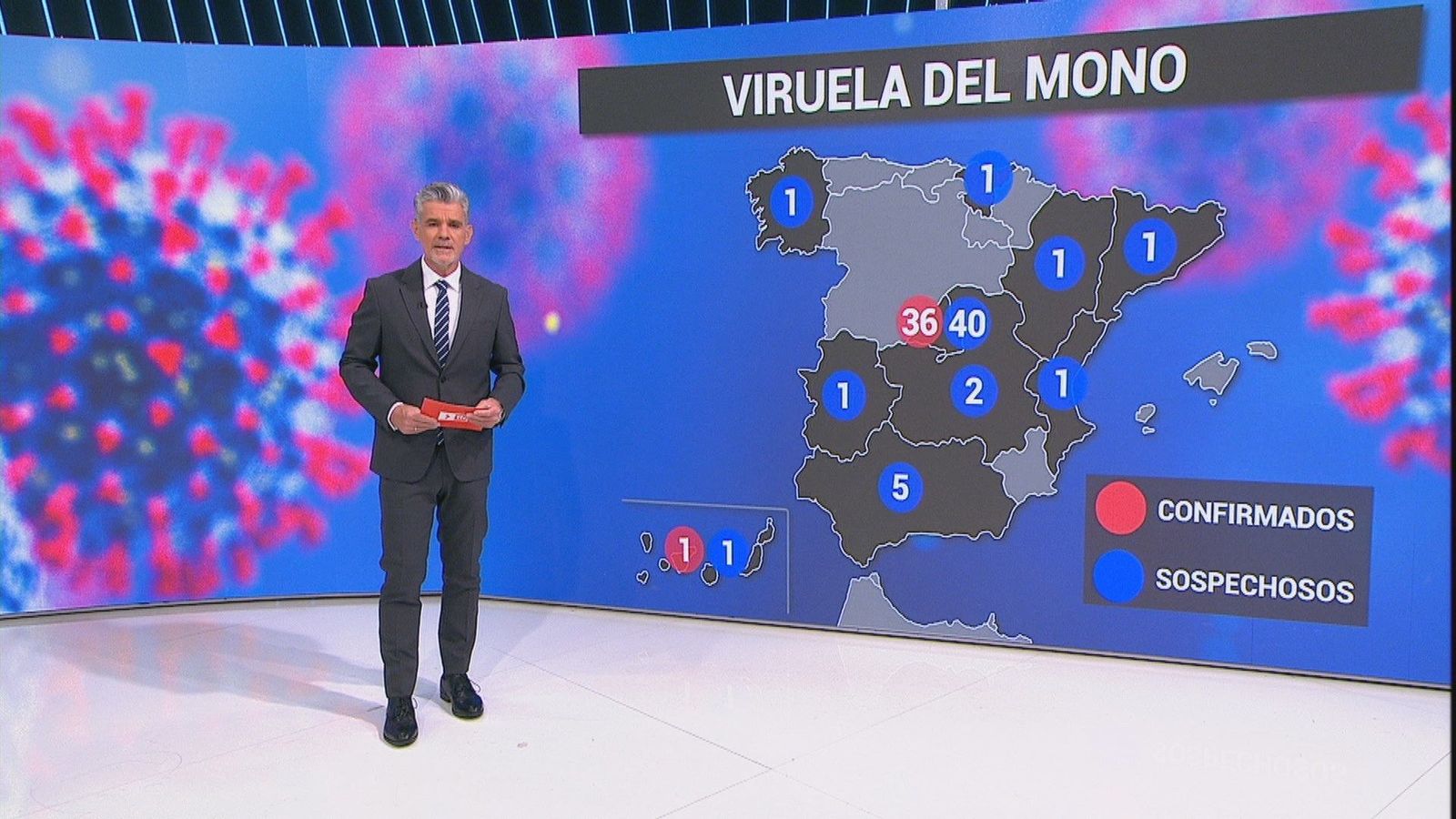 Ya hay más de 50 casos de viruela del mono en España entre confirmados y sospechosos