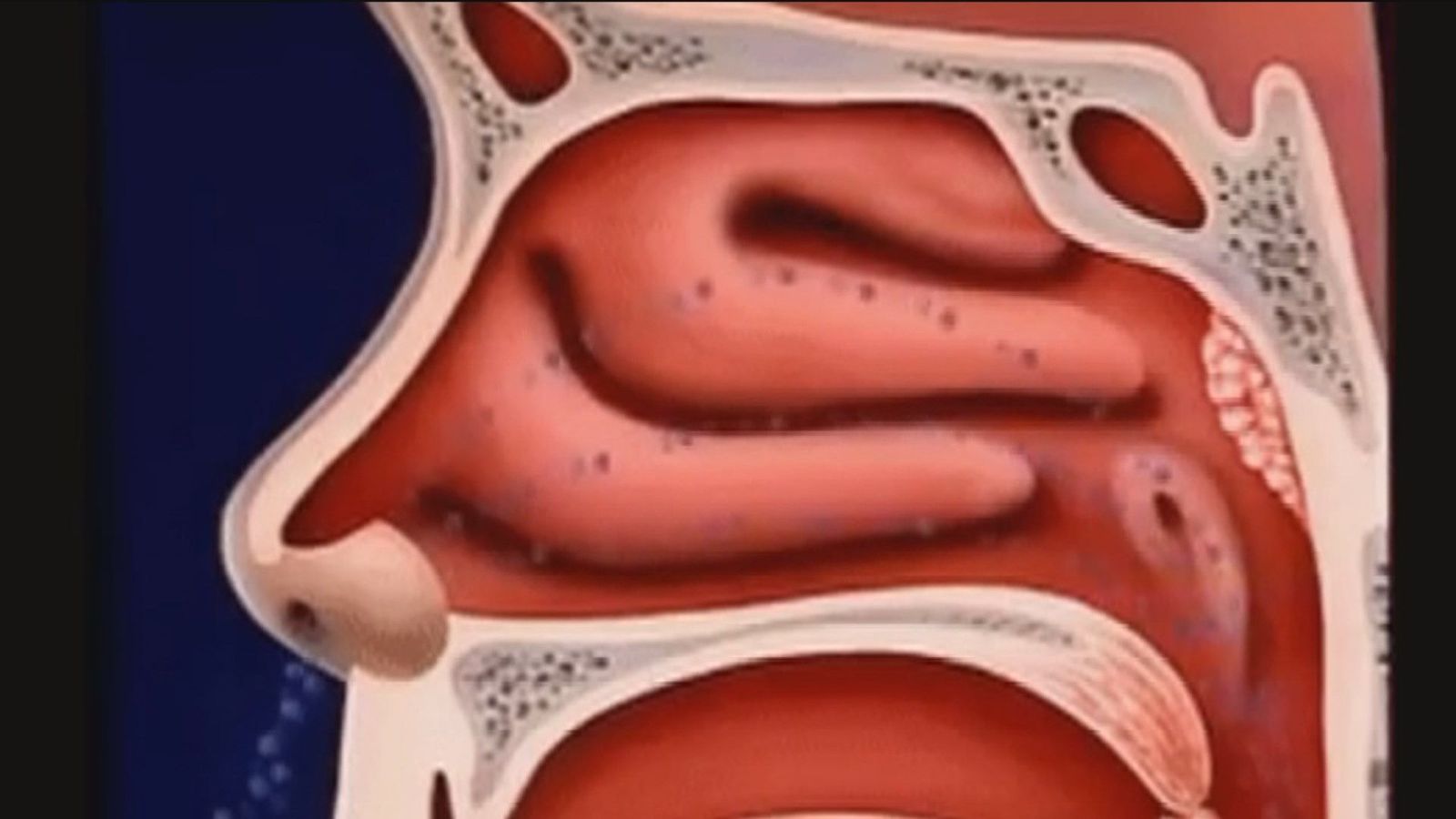 La falta de lluvia multiplica los casos de rinitis, alergias y problemas respiratorios