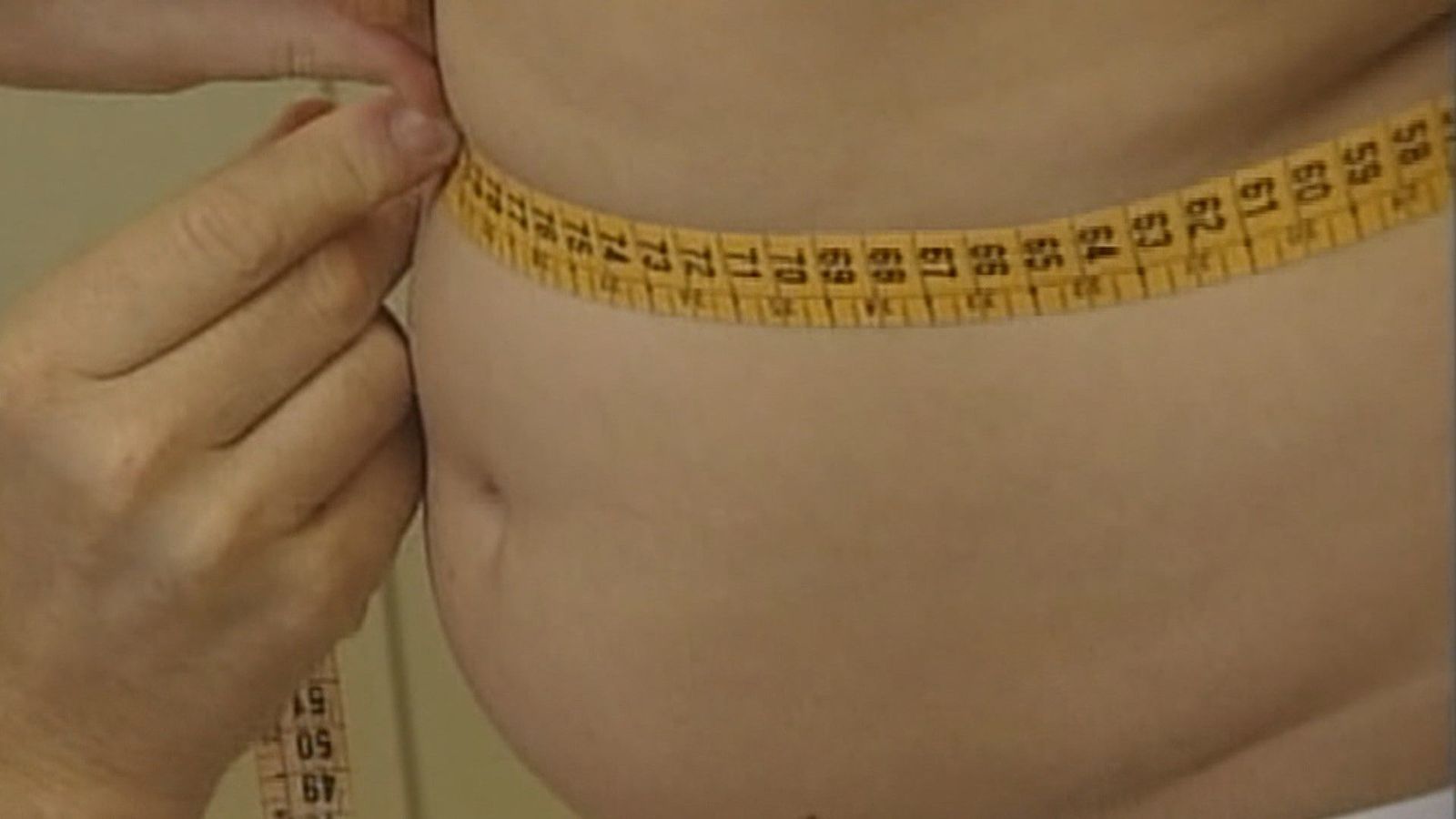 La obesidad ya afecta a más de 1.000 millones de personas en el mundo