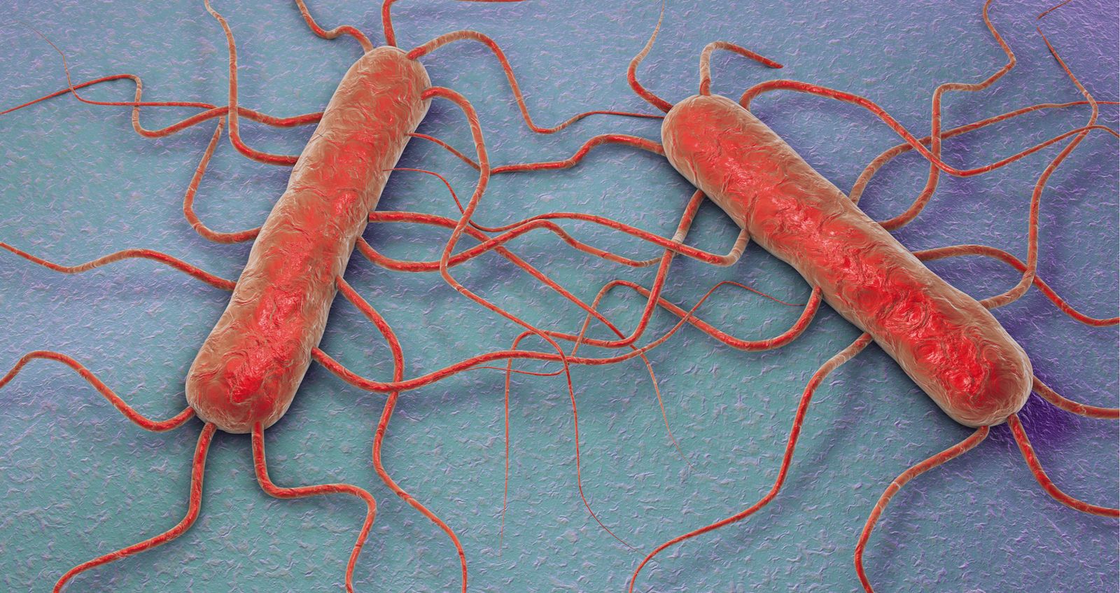 ¿Qué es la listeriosis y cómo nos afecta?