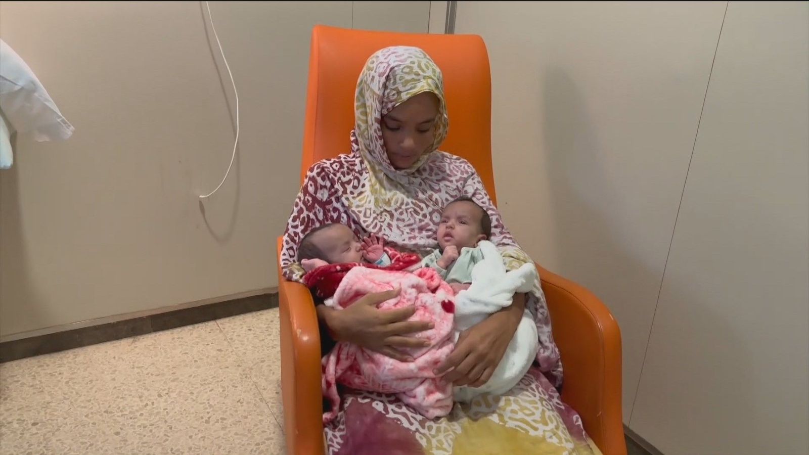 Las dos siamesas de Mauritania evolucionan tras ser separadas hace 9 días