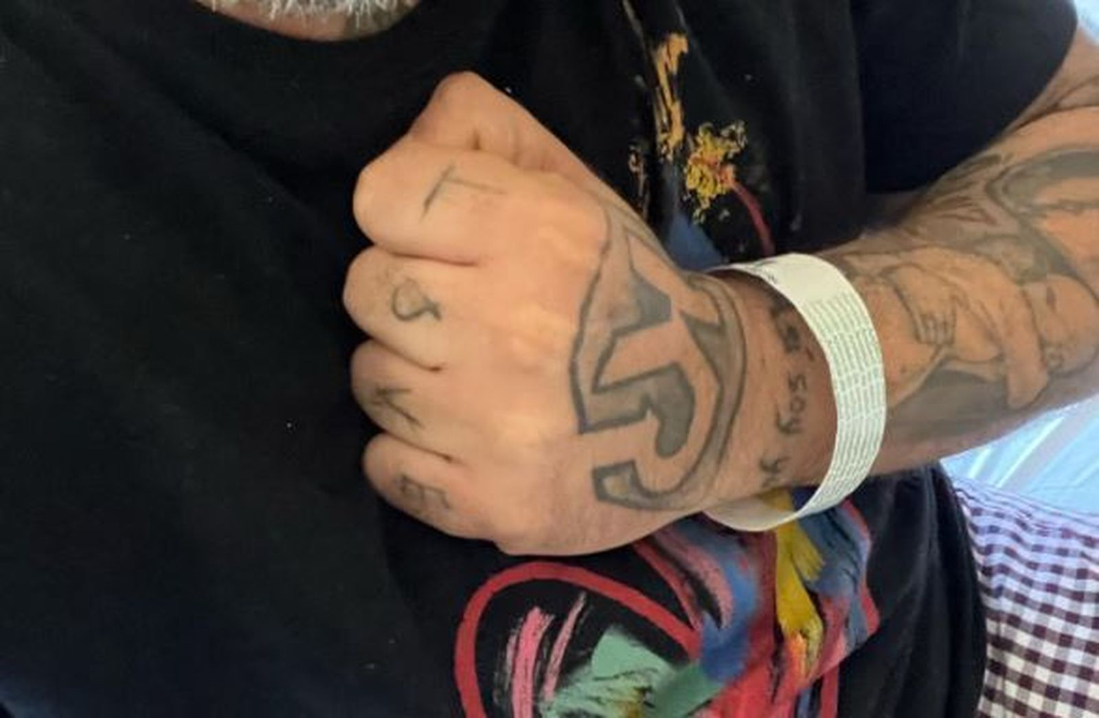 Foto de Kiko Rivera, ingresado en el hospital
