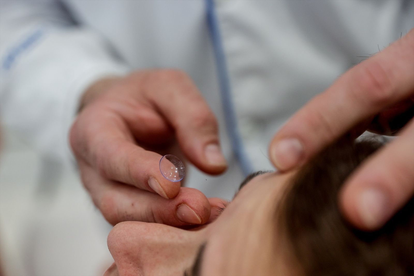 Una oculista pone una lentilla a una paciente