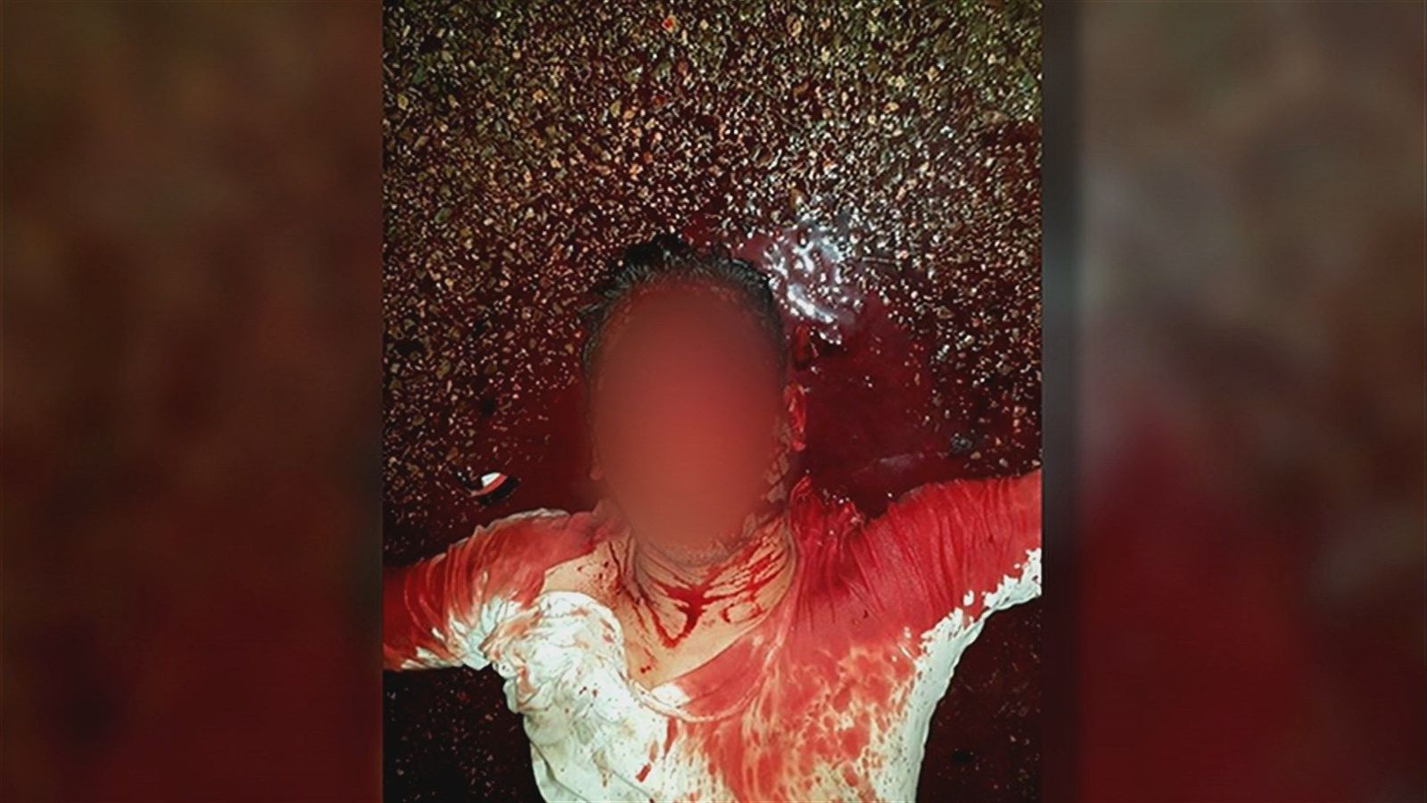 La policía busca a los autores de una brutal agresión a un joven en Aluche