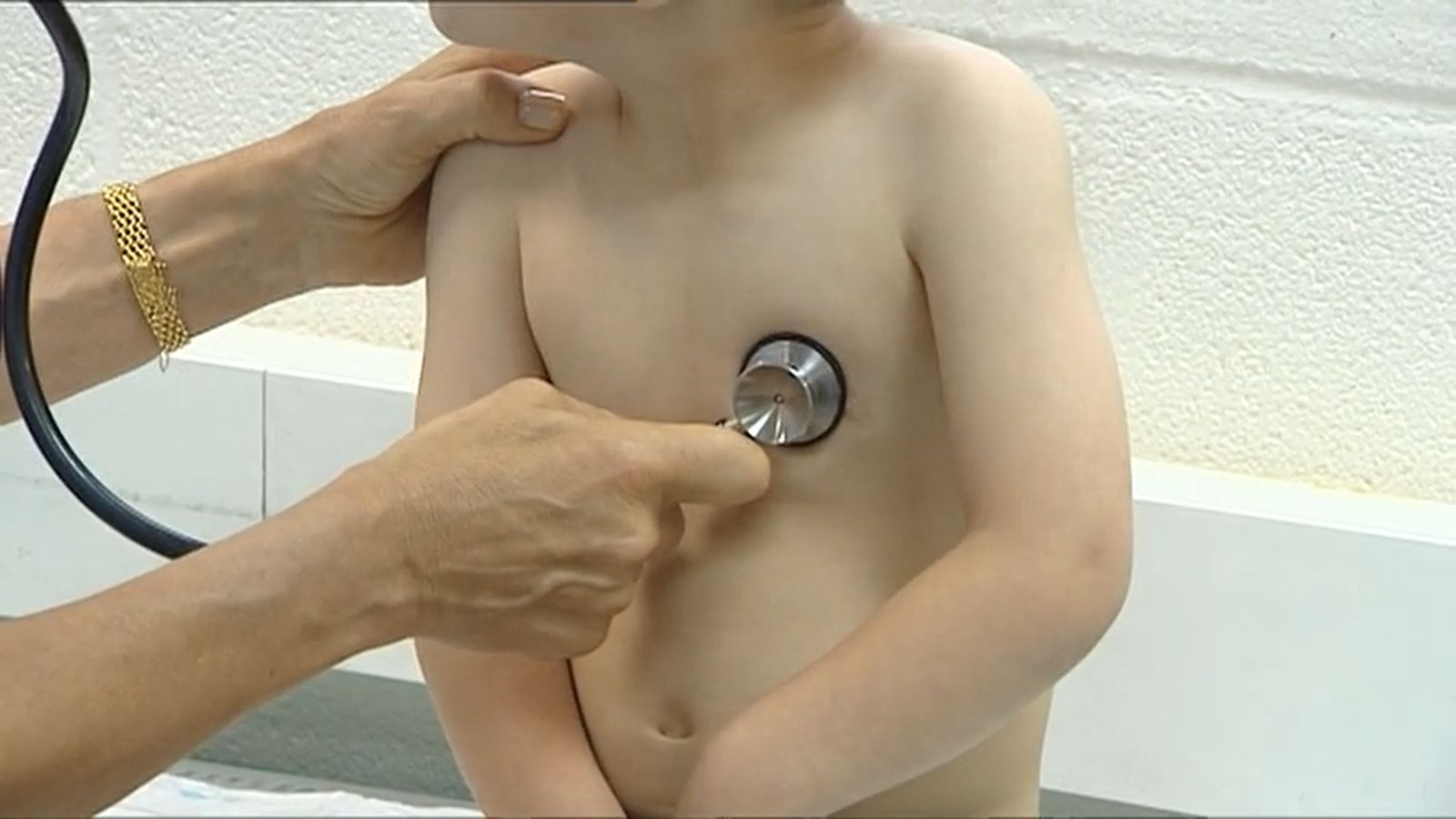 Se disparan las consultas de urgencias por bronquiolitis asociadas al Virus Respiratorio Sincitial