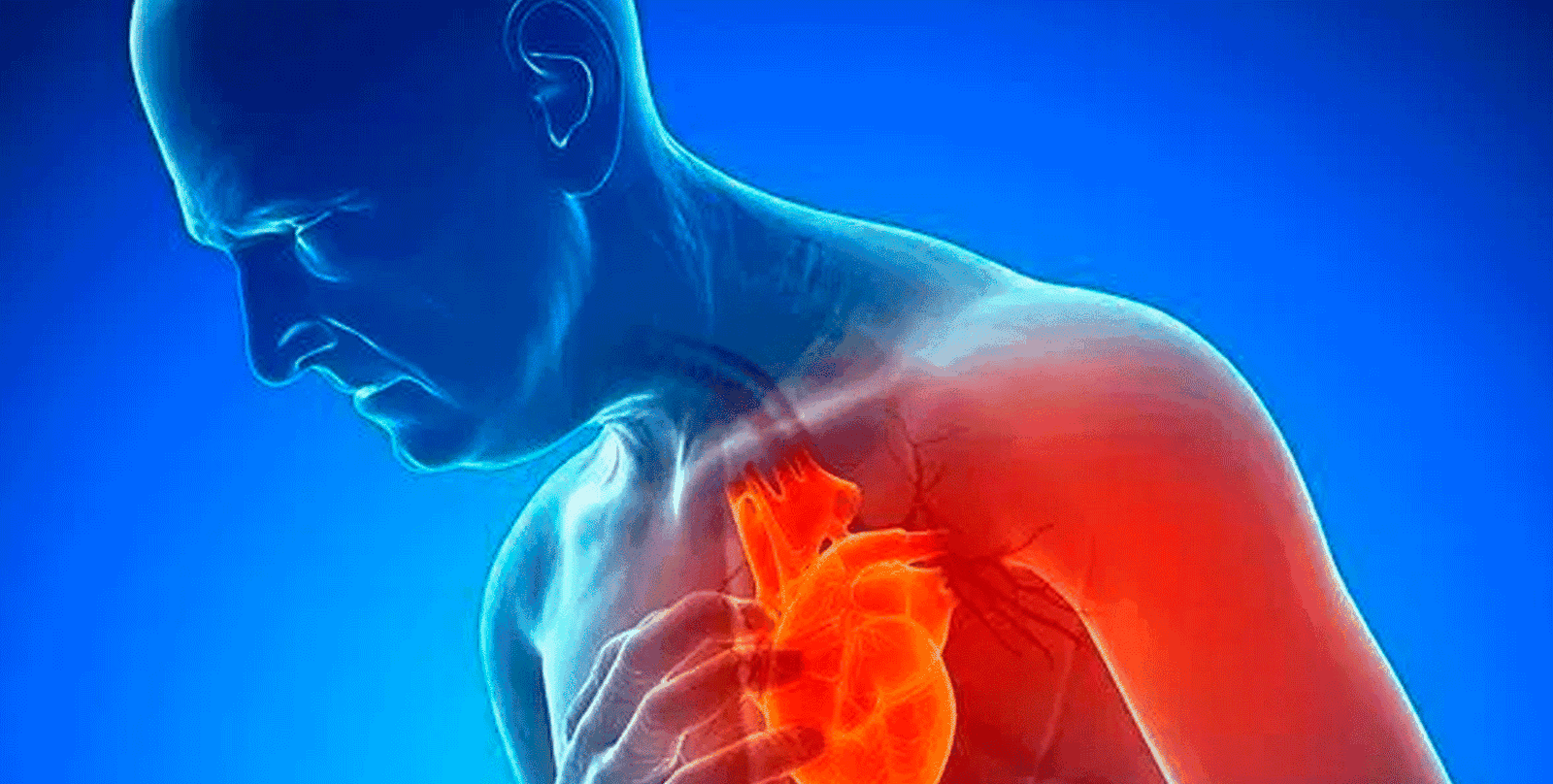 Síntomas de un infarto en mujeres y hombres