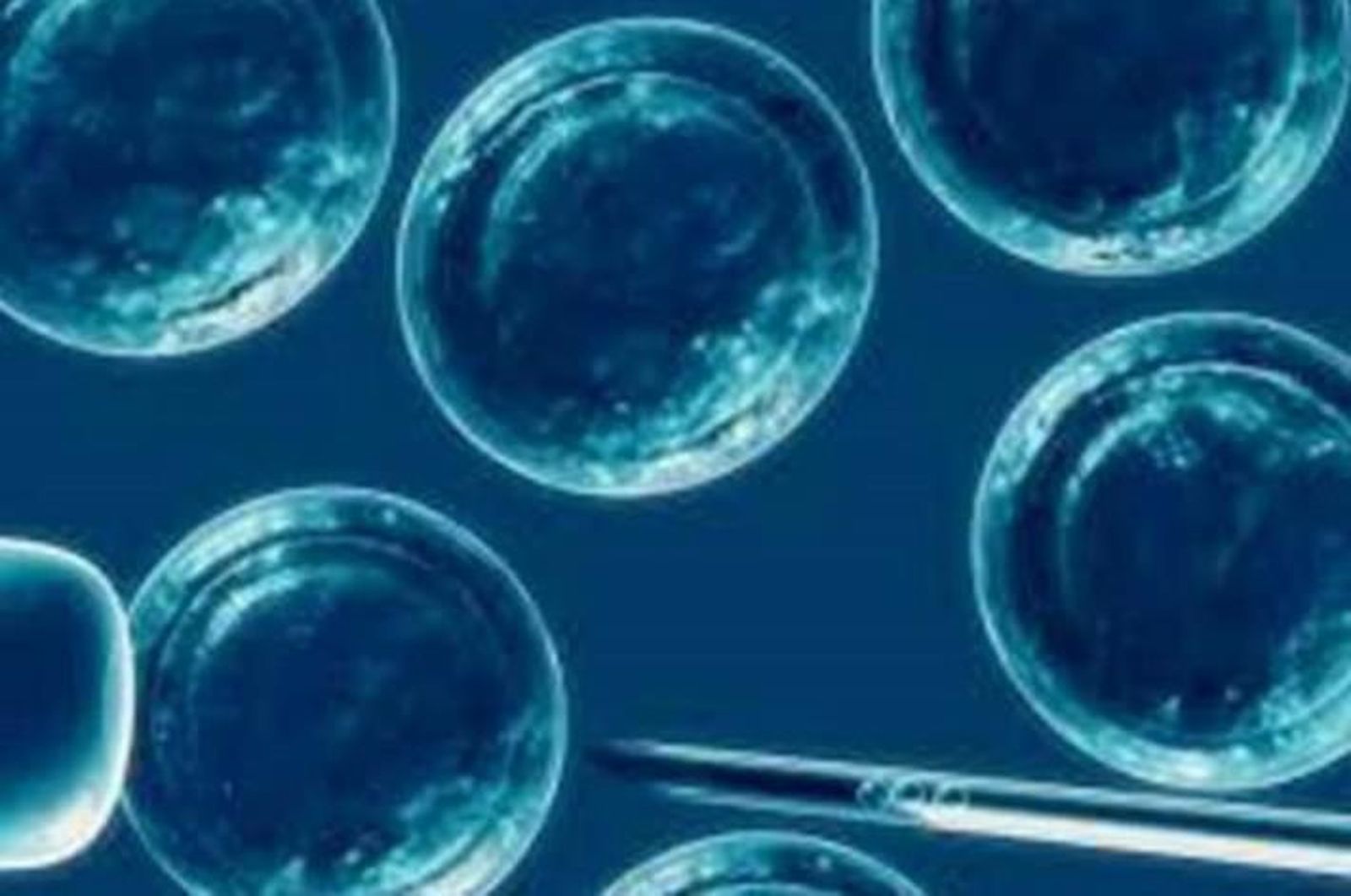 Logran eliminar el virus del Sida con el trasplante de células madre