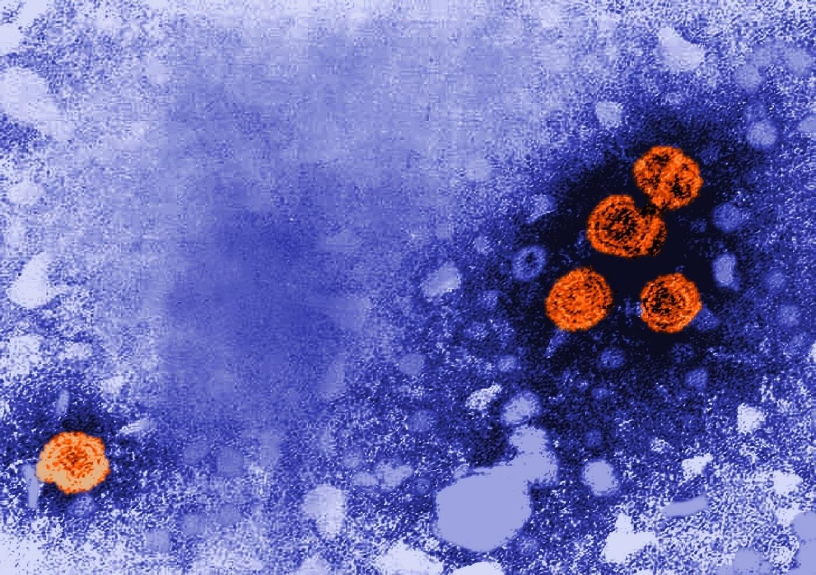 Hepatitis