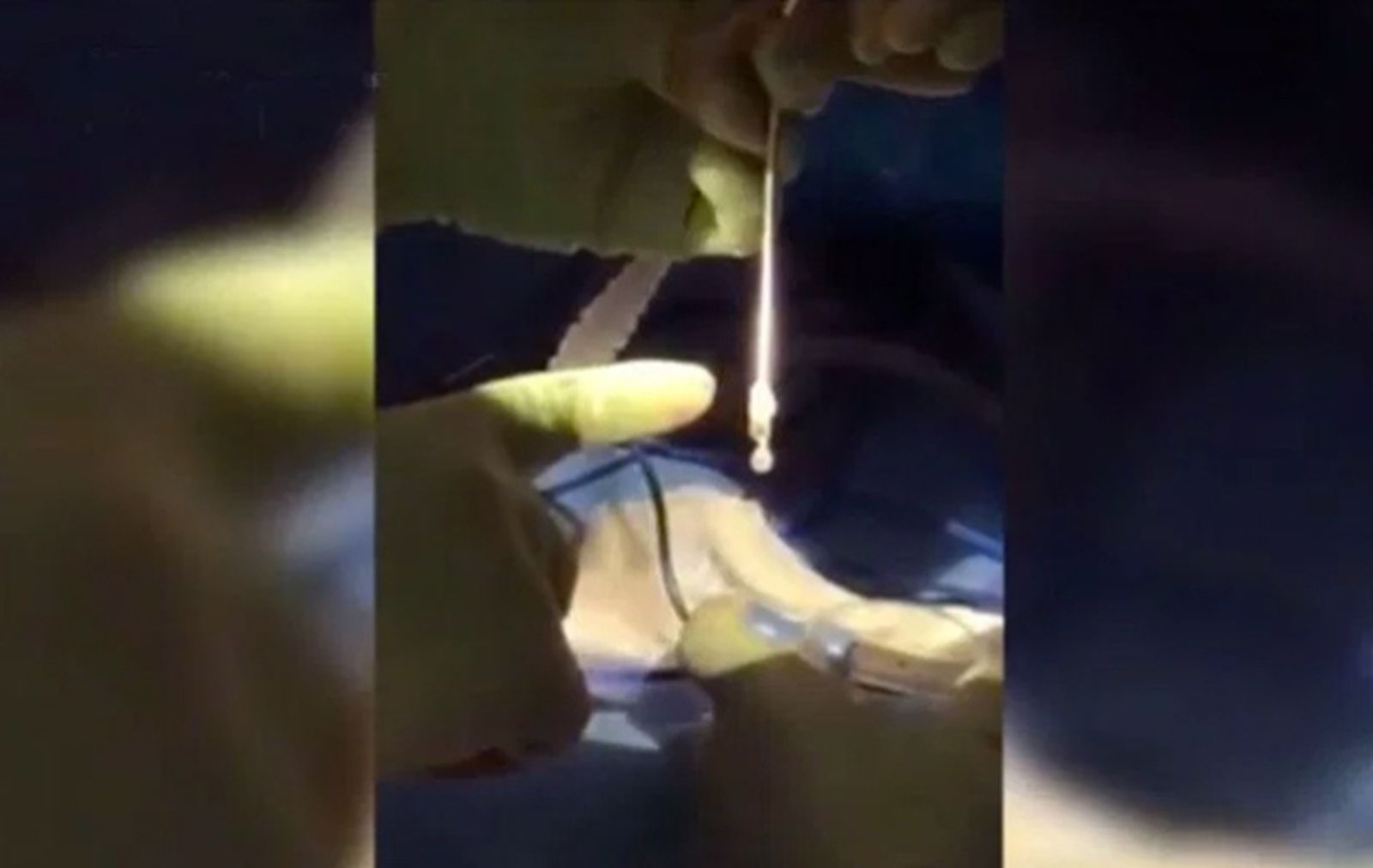 larva_cerebro_435.jpg