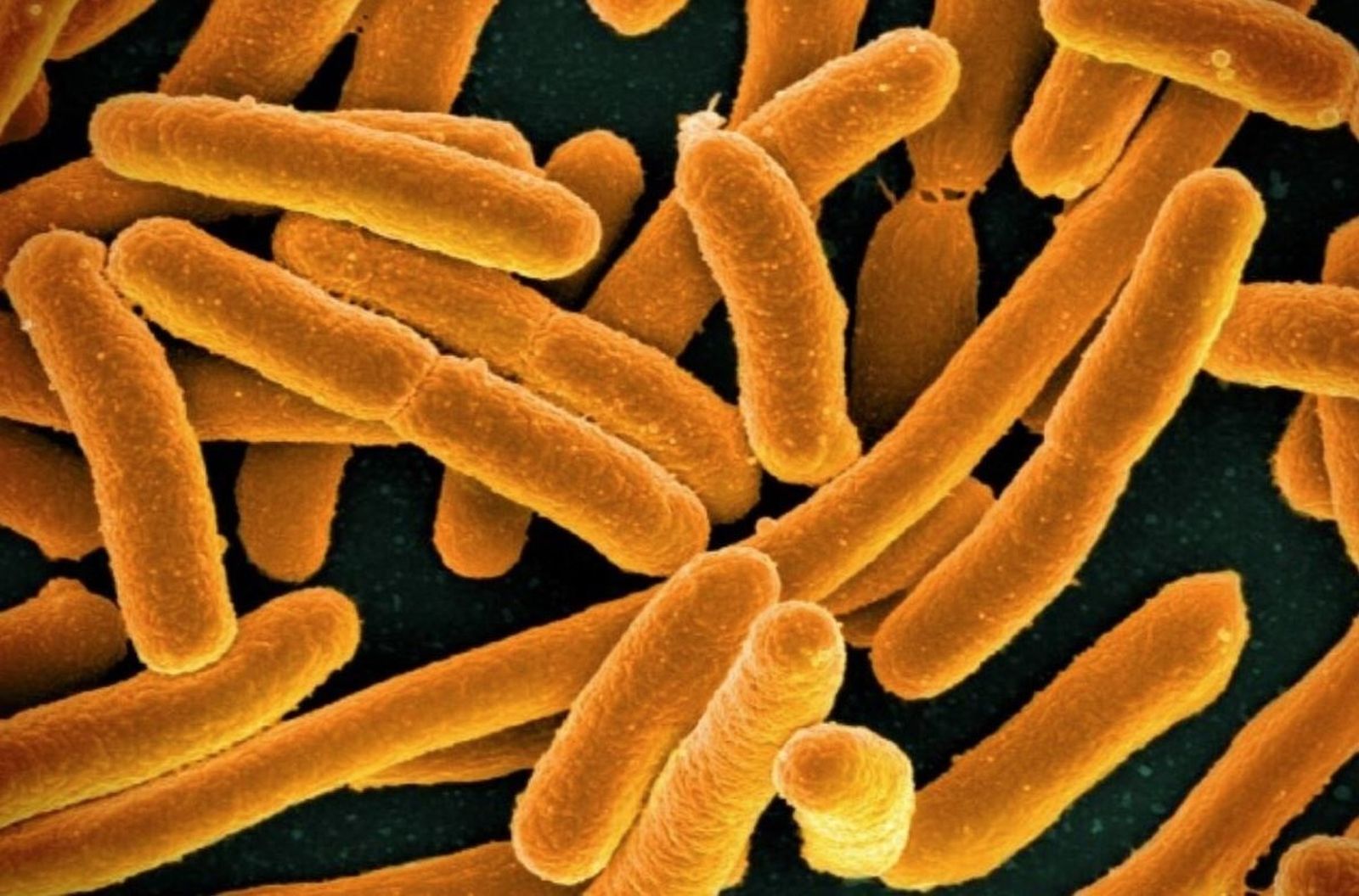 Imagen microscópica de la bacteria E. Coli