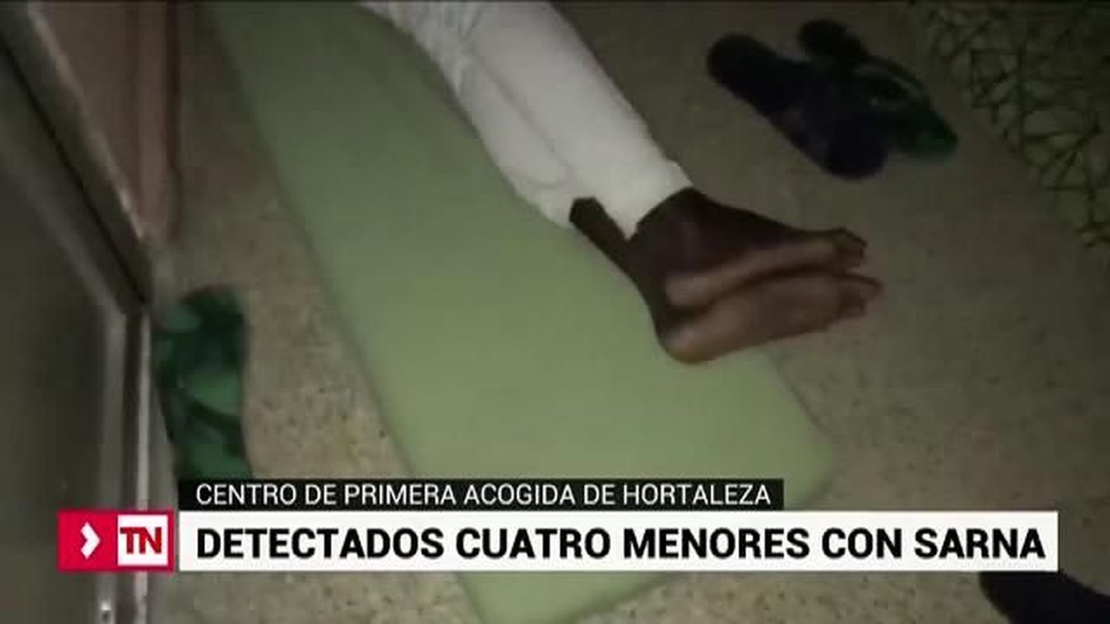 La sarna llega al Centro de Primera Acogida de Hortaleza