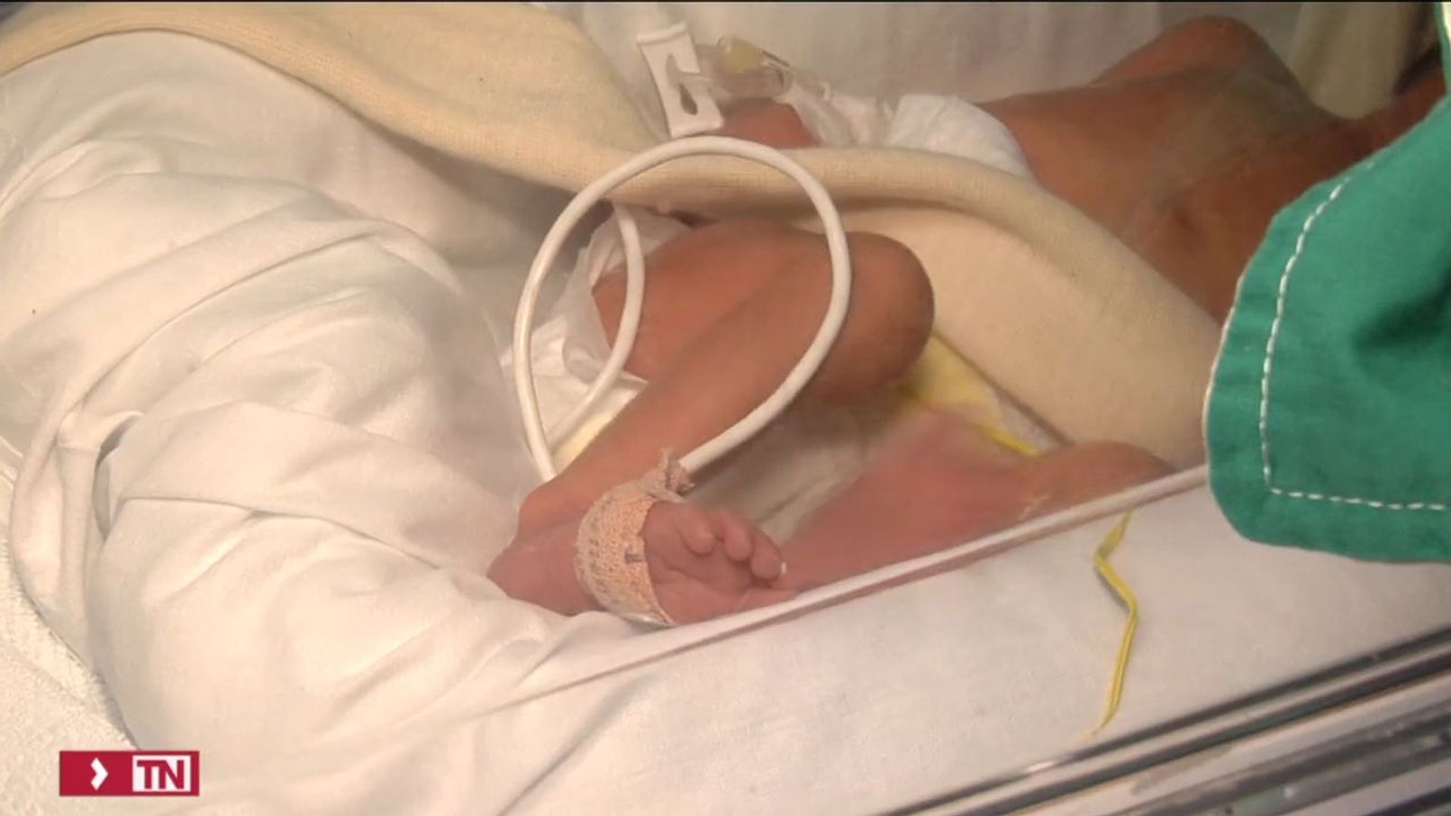 El aumento de los bebés prematuros
