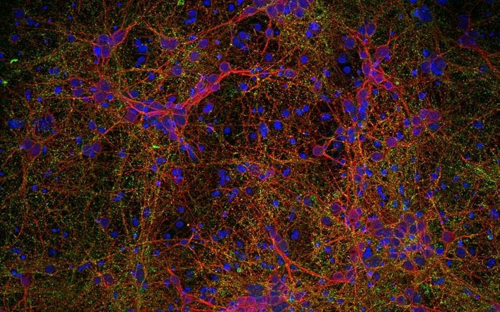 Imagen microscópica de células neurales con nanopartículas de óxido de hierro: neuronas (rojo), sinapsis (verde) y núcleos celulares (azul)