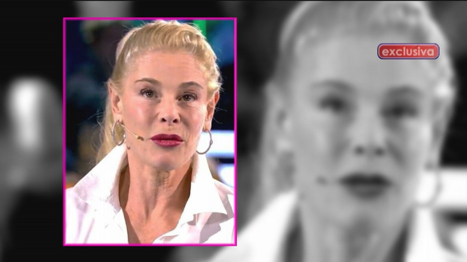 ¿Qué se ha hecho Belén Rueda en la cara?