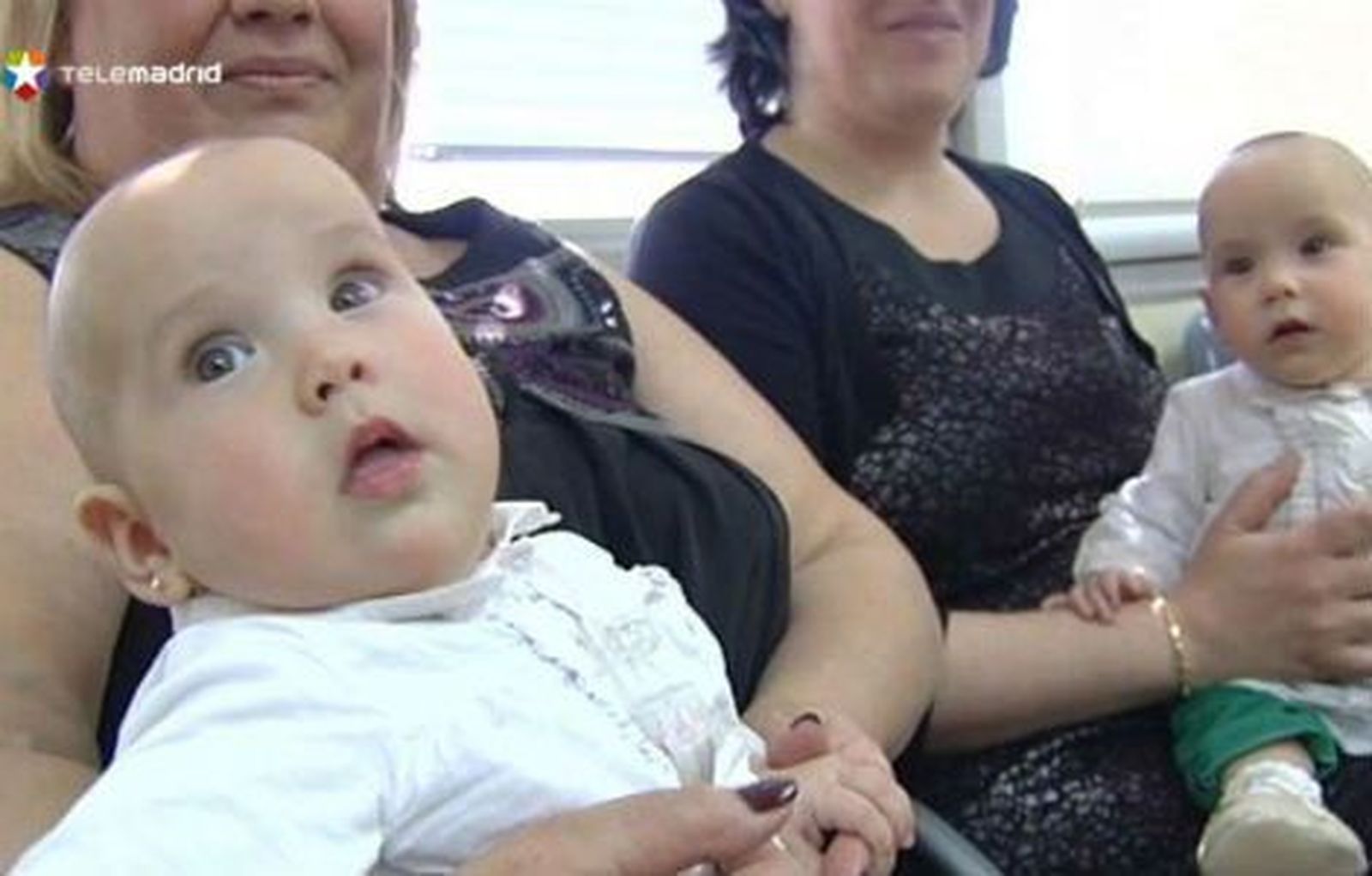Vall dHebron separa dos siamesas unidas por el abdomen que compartían hígado