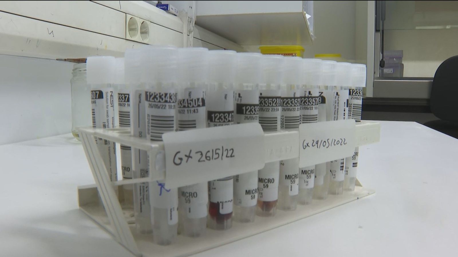Madrid comienza a realizar las pruebas PCR y secuenciación genómica de la viruela del mono
