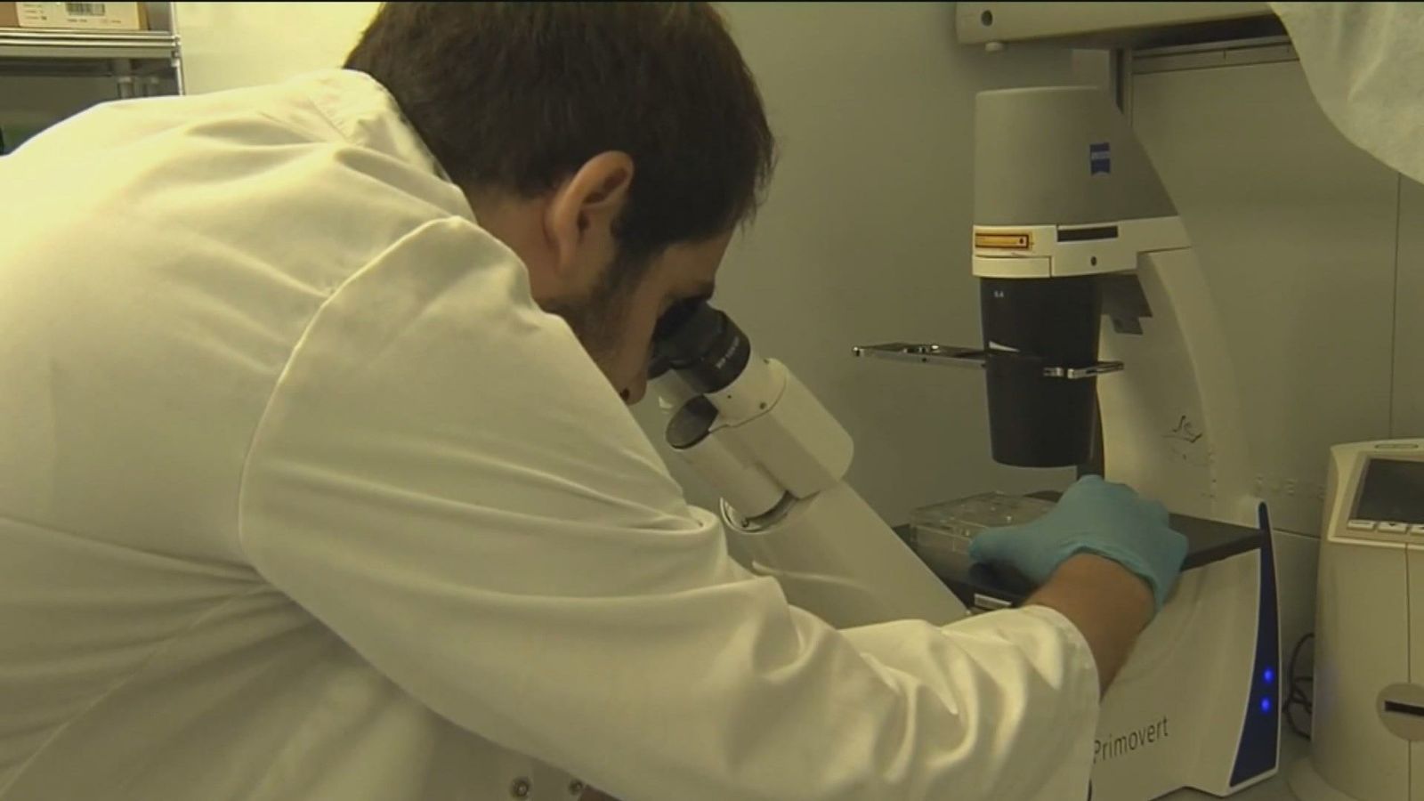 Científicos españoles identifican las células causantes de la metástasis en el cáncer de colon
