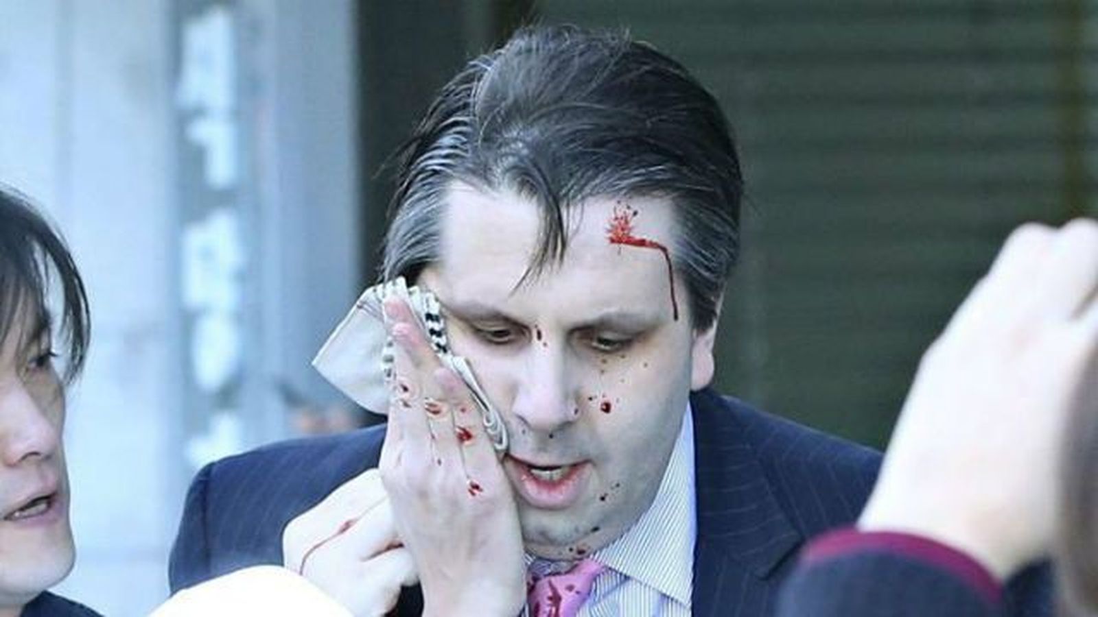 Herido el embajador estadounidense en Seúl tras ser atacado con una cuchilla