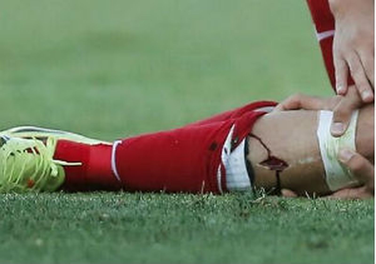 La tibia de Diego Costa