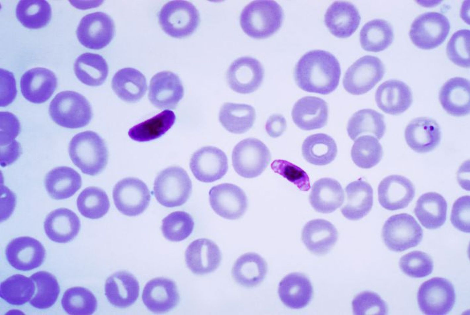 Plasmodium falciparum en una imagen micróscopica