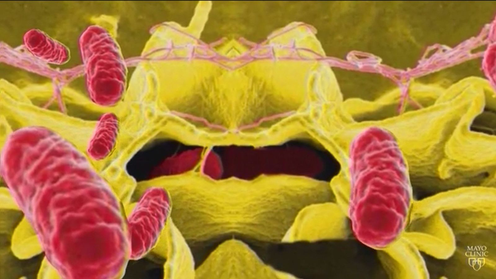 Los expertos alertan sobre intoxicaciones alimentarias que pueden llegar a ser mortales como la Salmonella