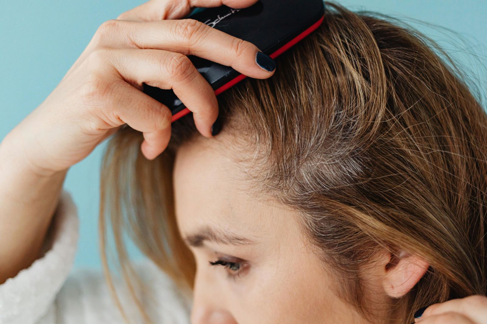 Dermatitis seborreica: causas, síntomas y tratamientos para mejorar la salud del cuero cabelludo