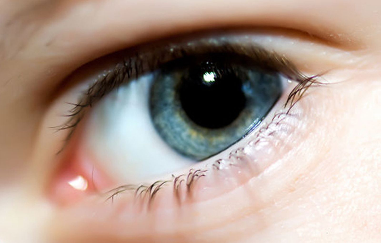 ojos_cornea