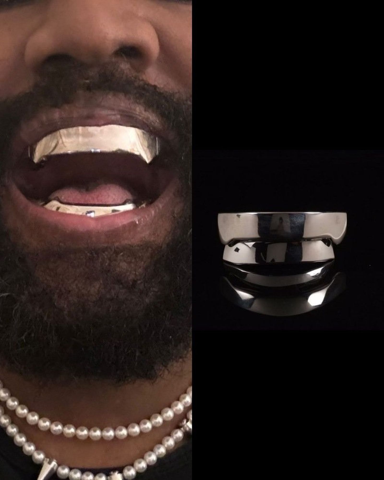 Dentadura de titanio de Kanye West