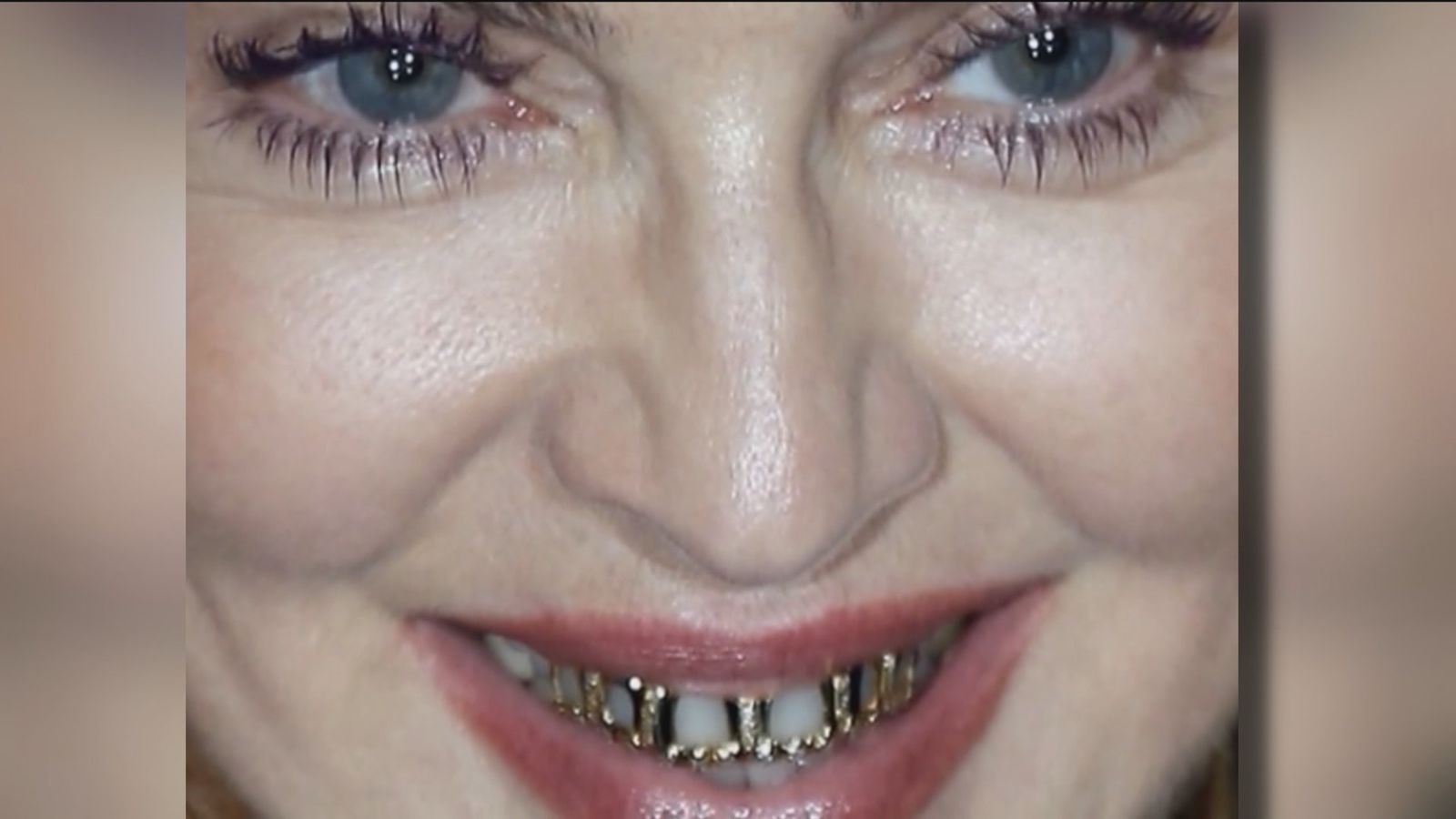 Piercing dental de Madonna