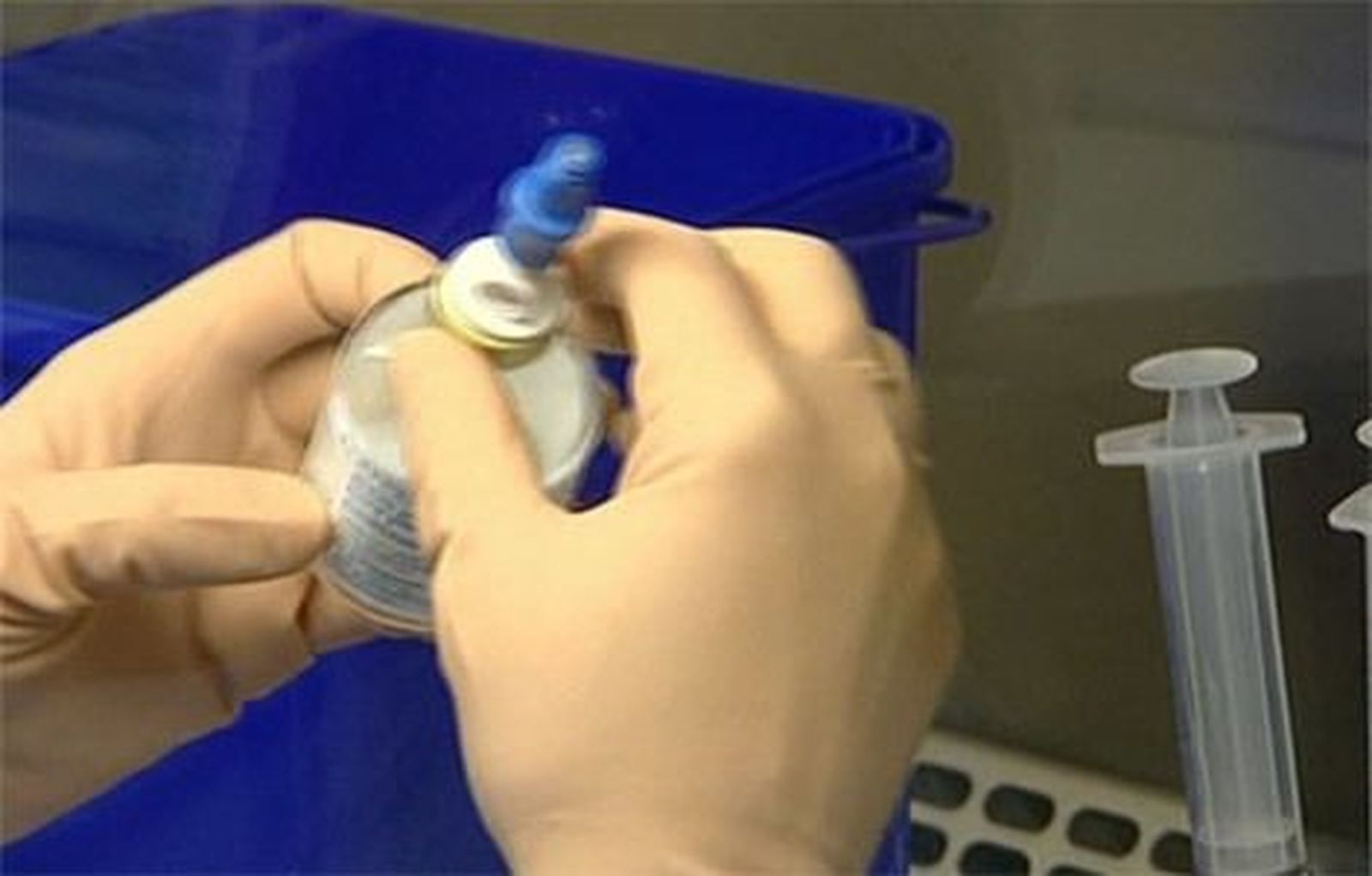 El Hospital Clínico San Carlos utilizará un robot para quimioterapia