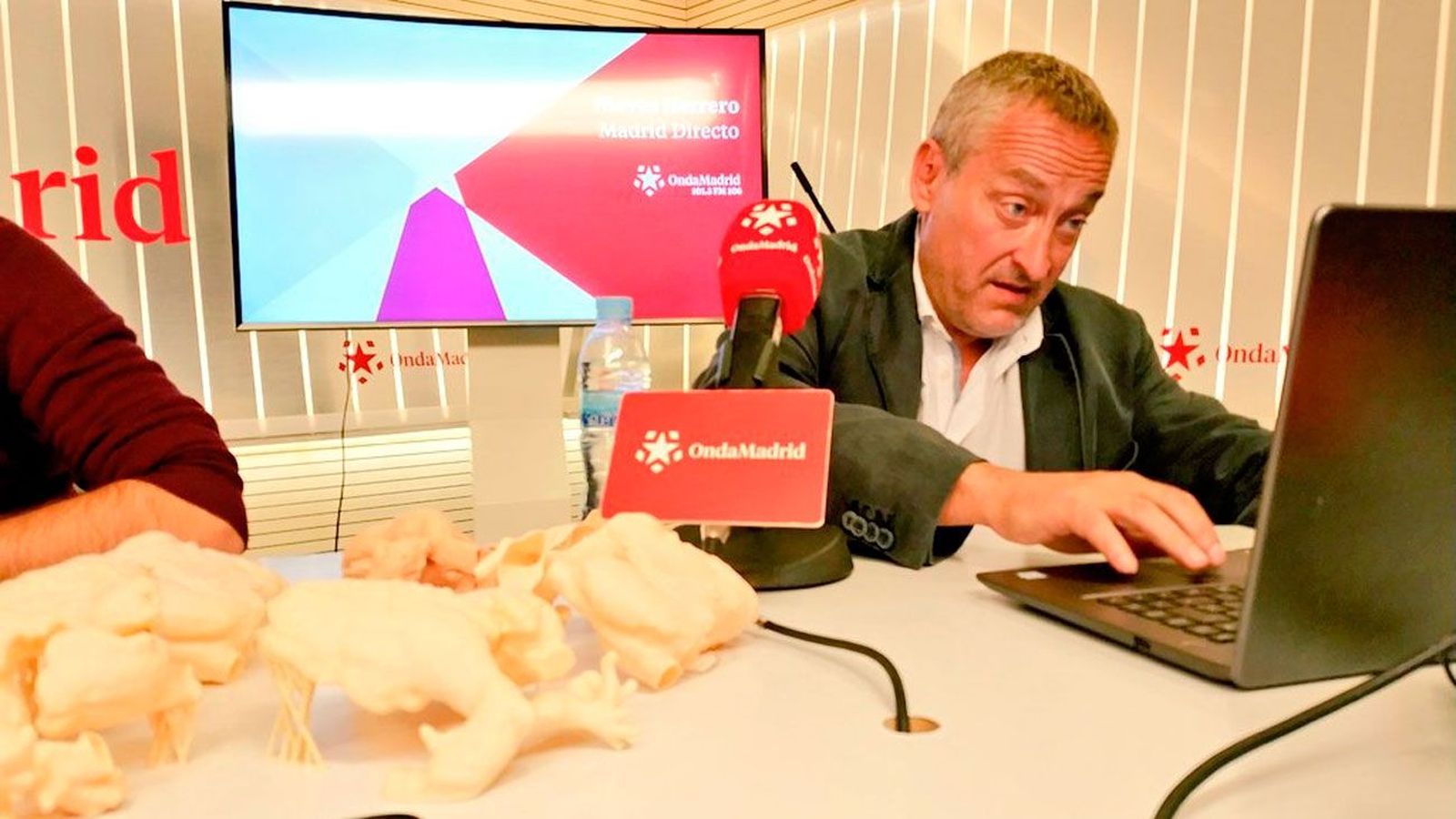 La impresión en tres dimensiones revoluciona la cirugía personalizada